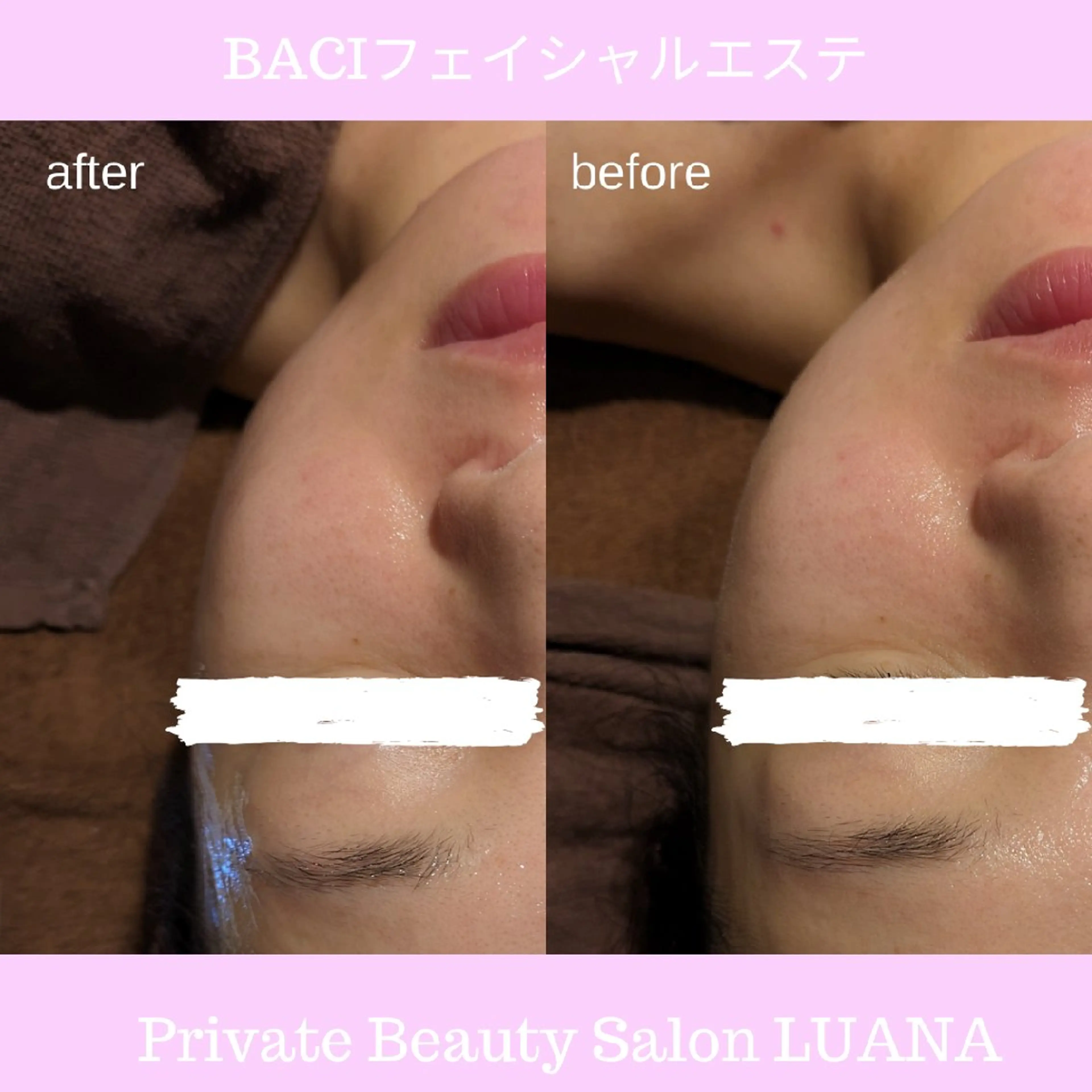 エステ 肌管理専門！BACI 加盟店LUANAのエステ・リラクイメージ