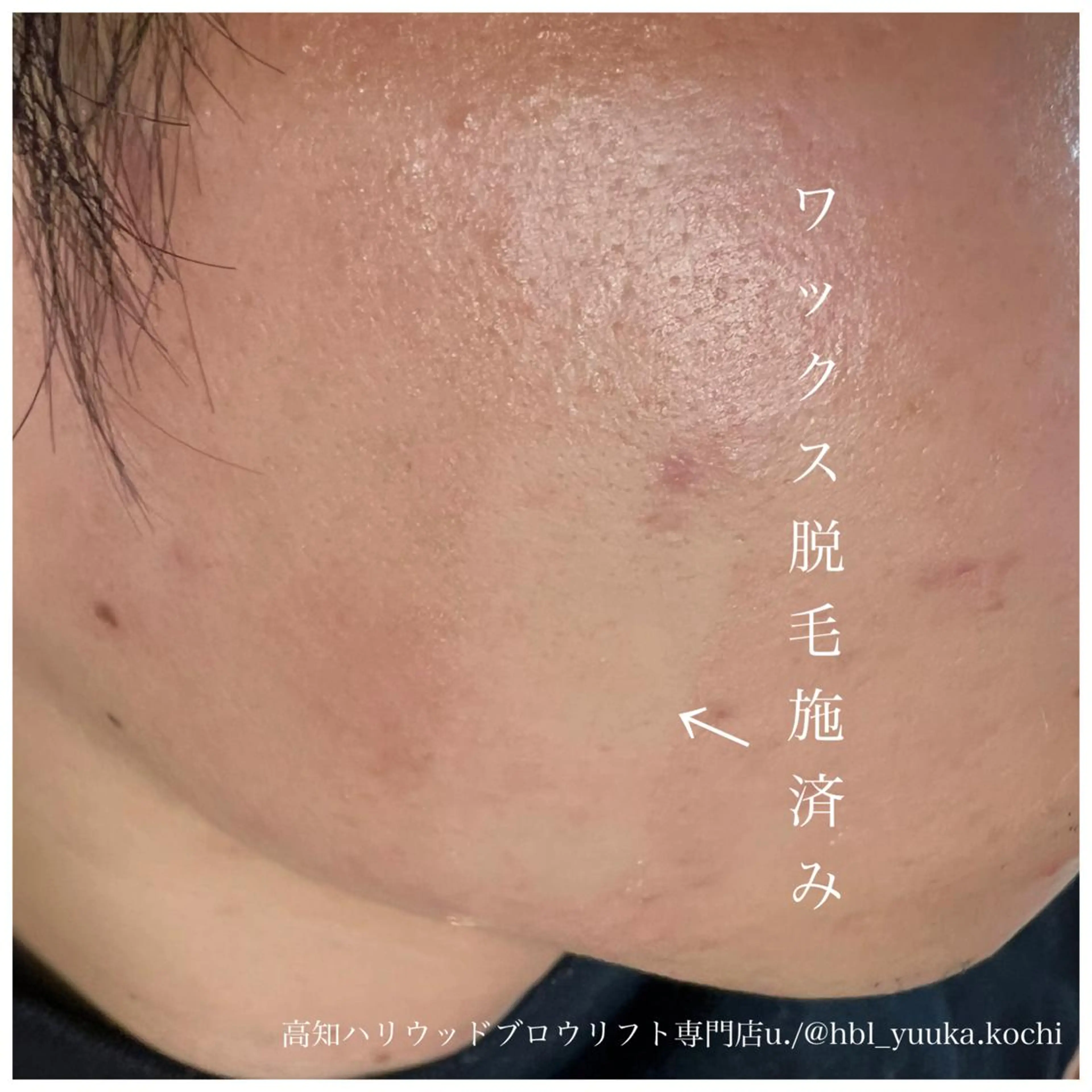 ワックス脱毛 その他(アイブロウ) ハリウッド ブロウリフト専門店の眉毛・アイブロウイメージ