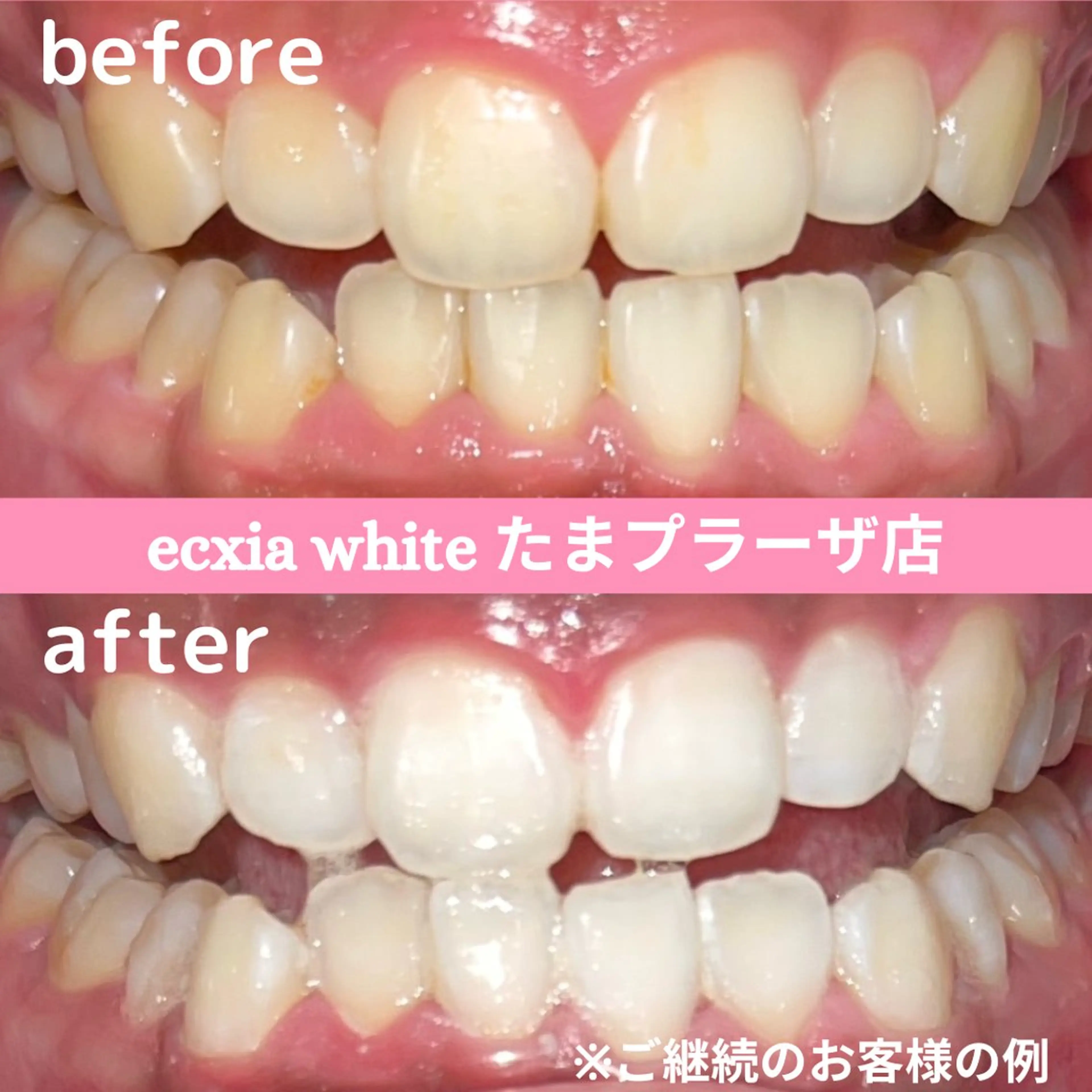 セルフホワイトニング　エクシアたまプラーザ店所属・セルフホワイトニング エクシアたまプラーザのその他イメージ