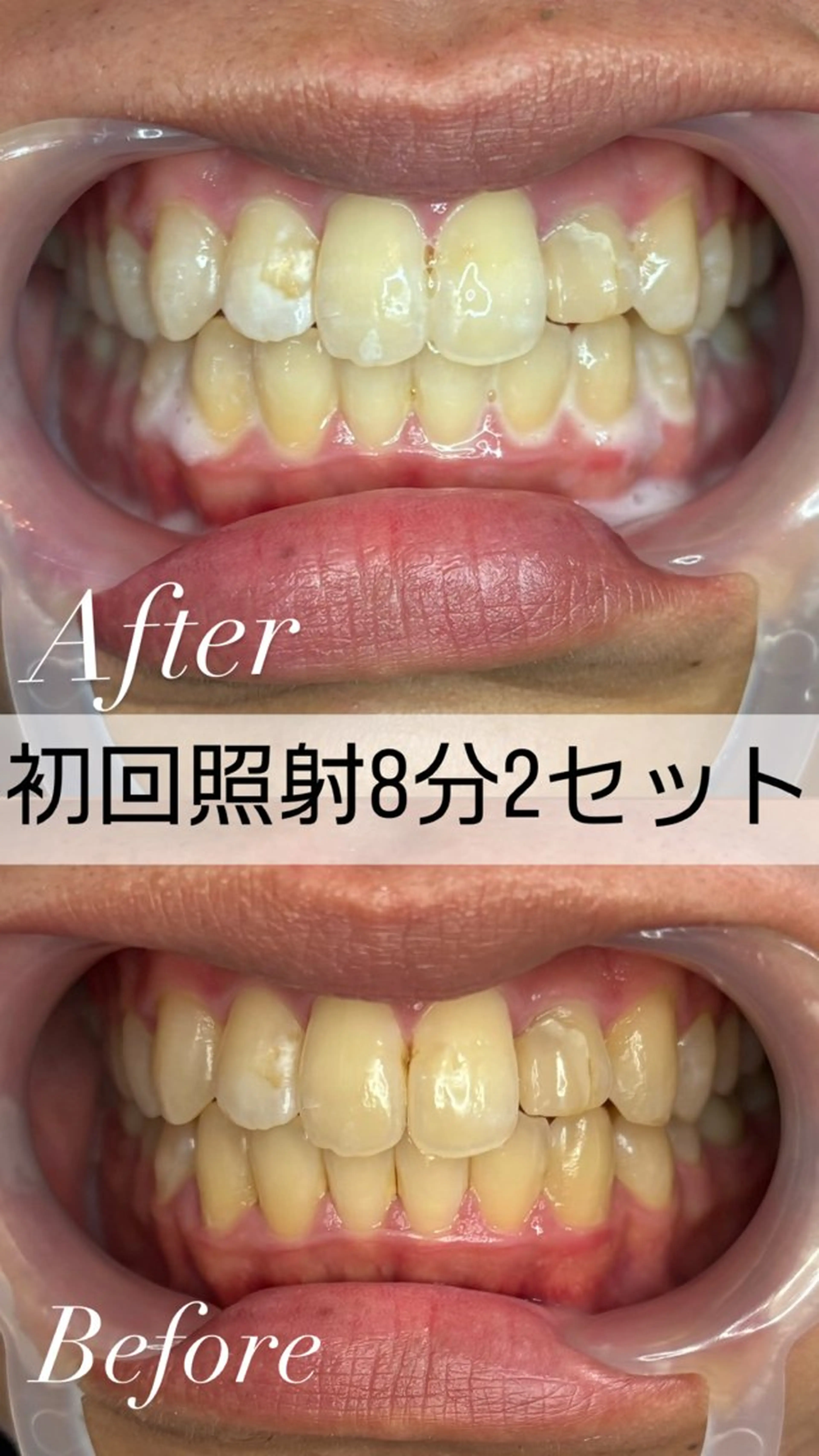 その他 トータルビューティー サロン　Lisseの眉毛・アイブロウイメージ