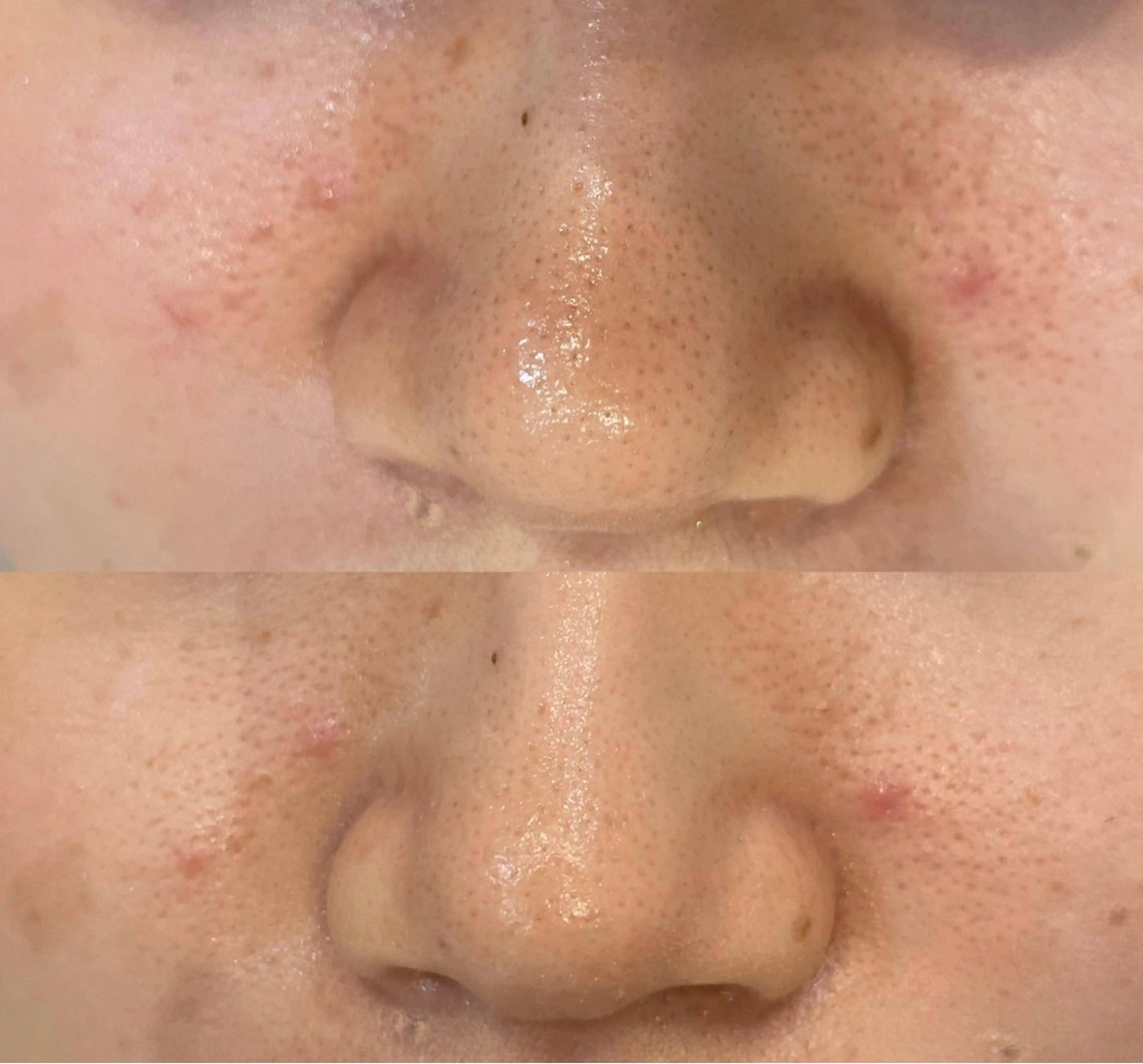 DeI'm   名古屋栄所属・小林 玲菜のエステ・リラクイメージ