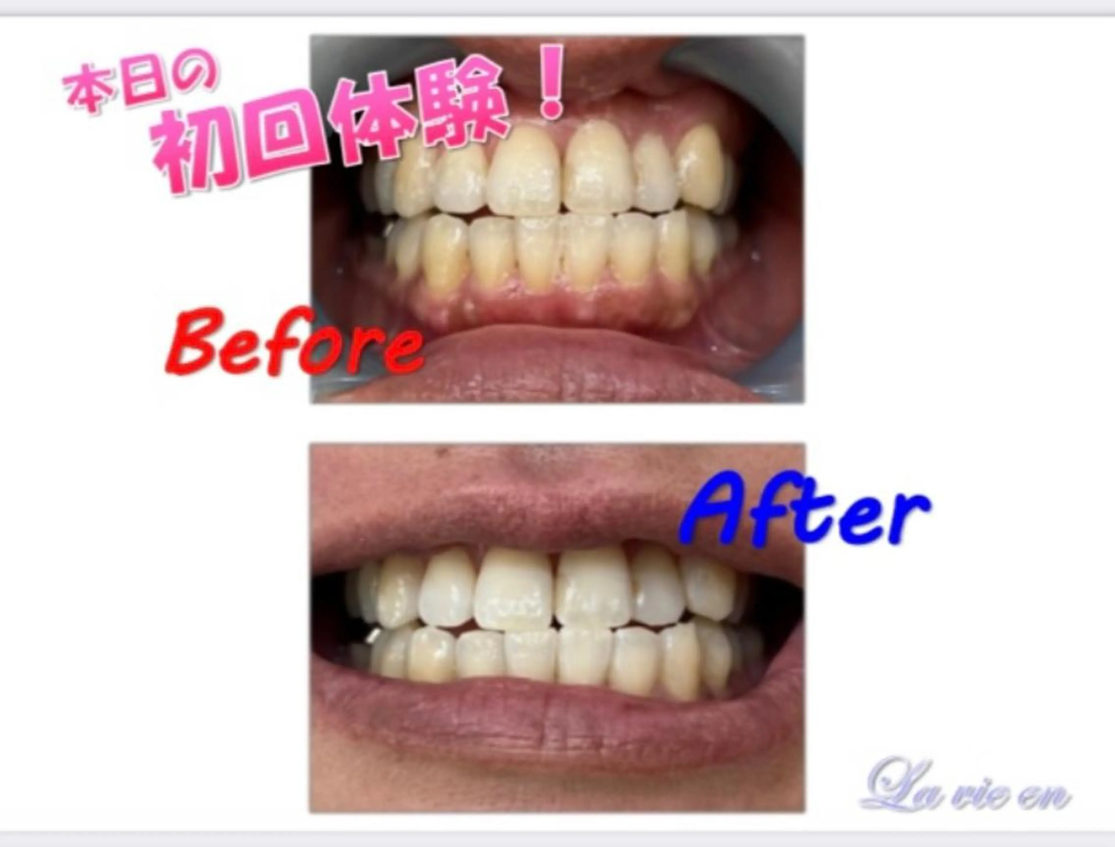 その他 セルフホワイトニングサロン　ラヴィアン所属・ホワイトニングサロン La vie enのその他イメージ