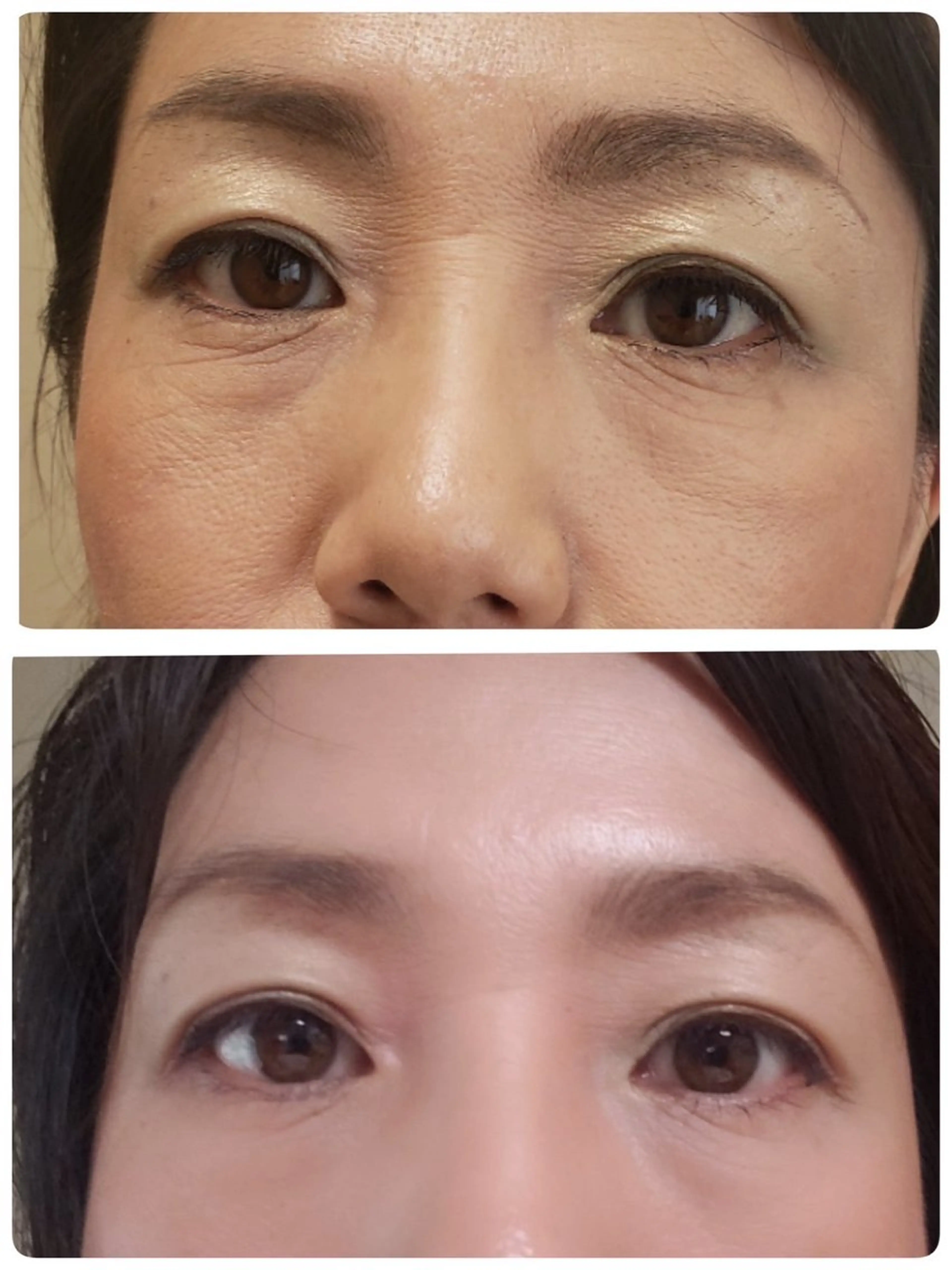 シミシワタルミ改善 美肌サロン松本浩美のエステ・リラクイメージ