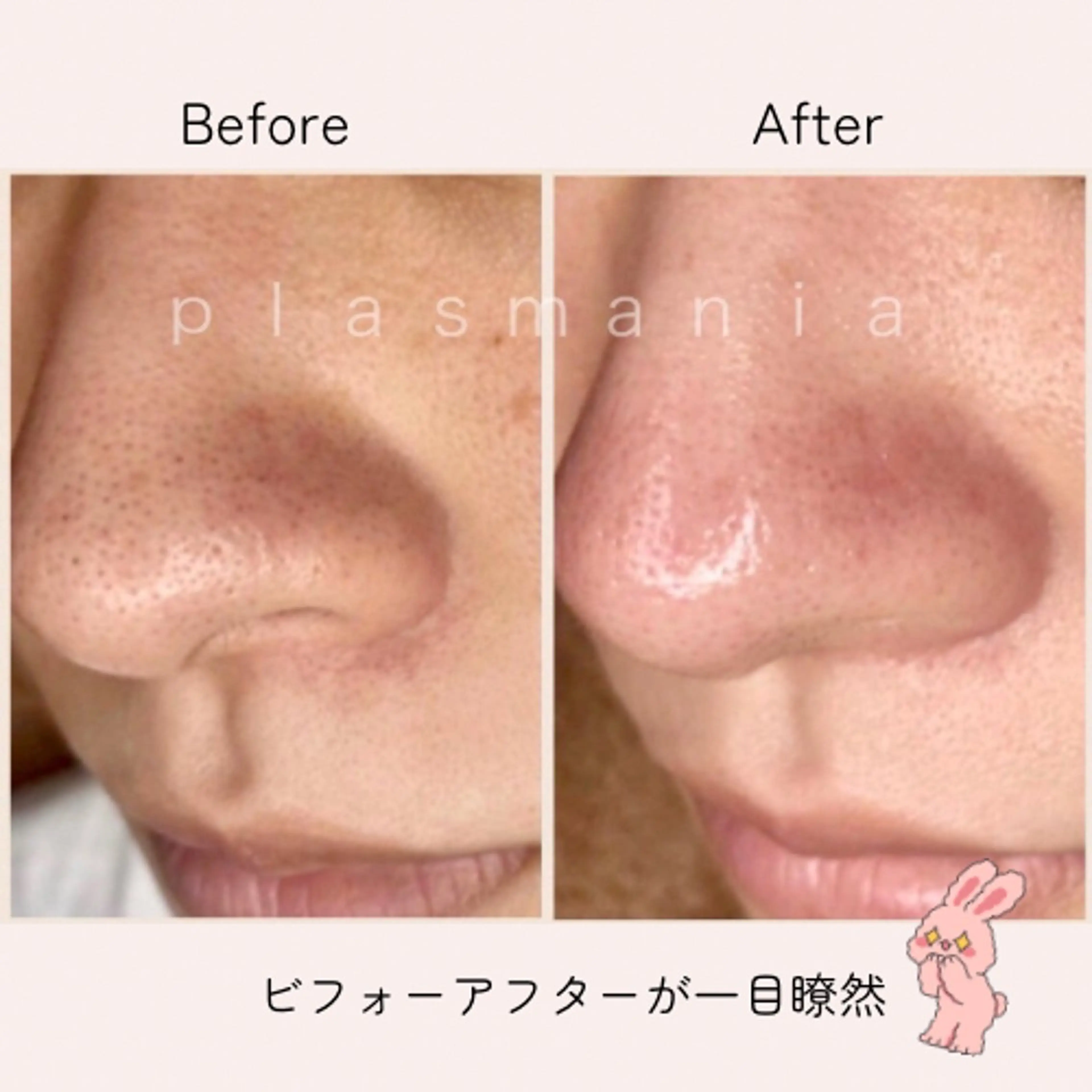 肌質改善｜エステ Connect ゆいのエステ・リラクイメージ