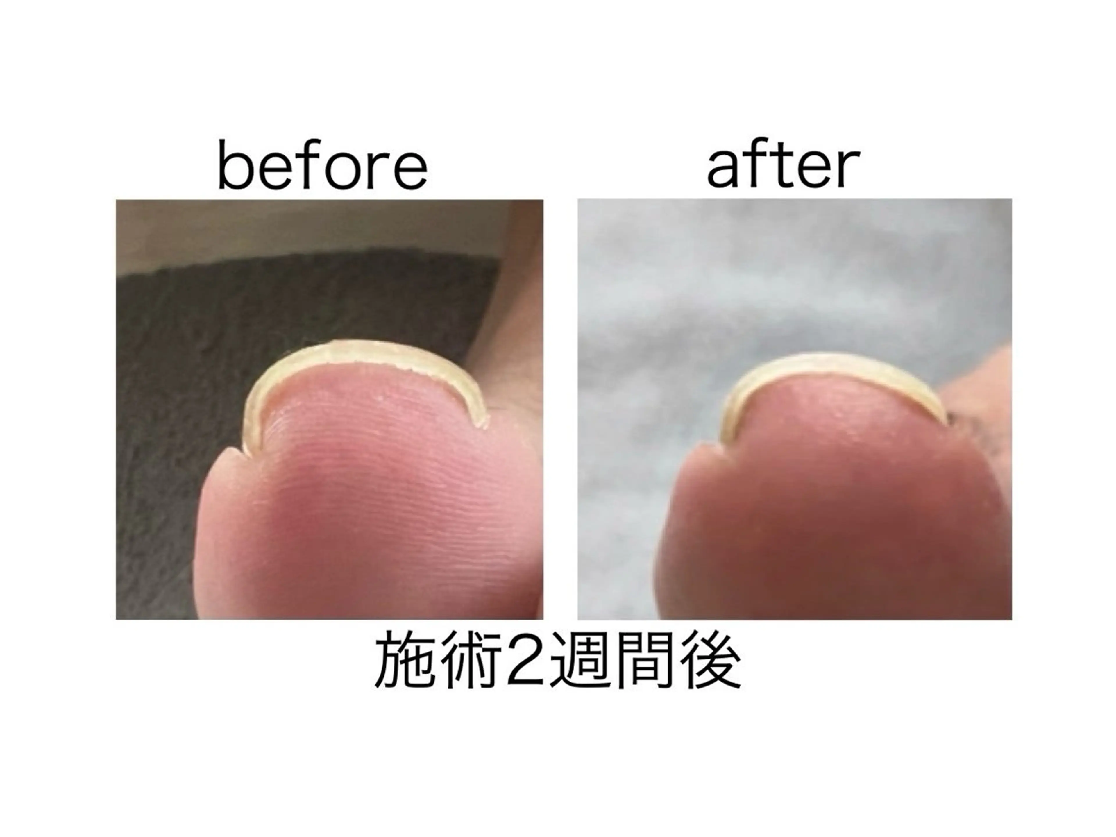 ネイル ジェルネイル private salon Aola所属・プライベートサロン アオラのネイルデザイン