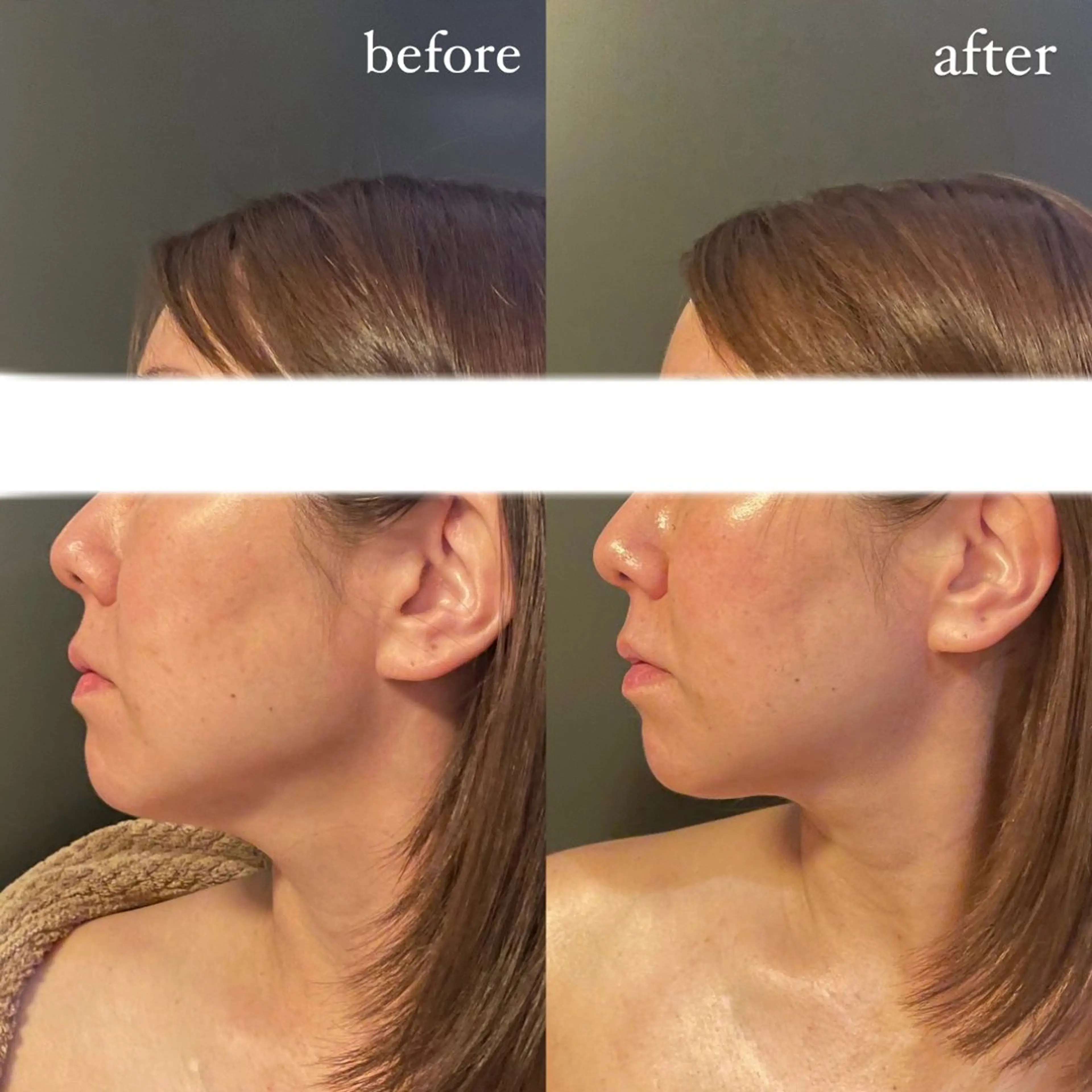 エステ リラク エステサロンino.colore'所属・小顔サロン ino.coloreのエステ・リラクイメージ