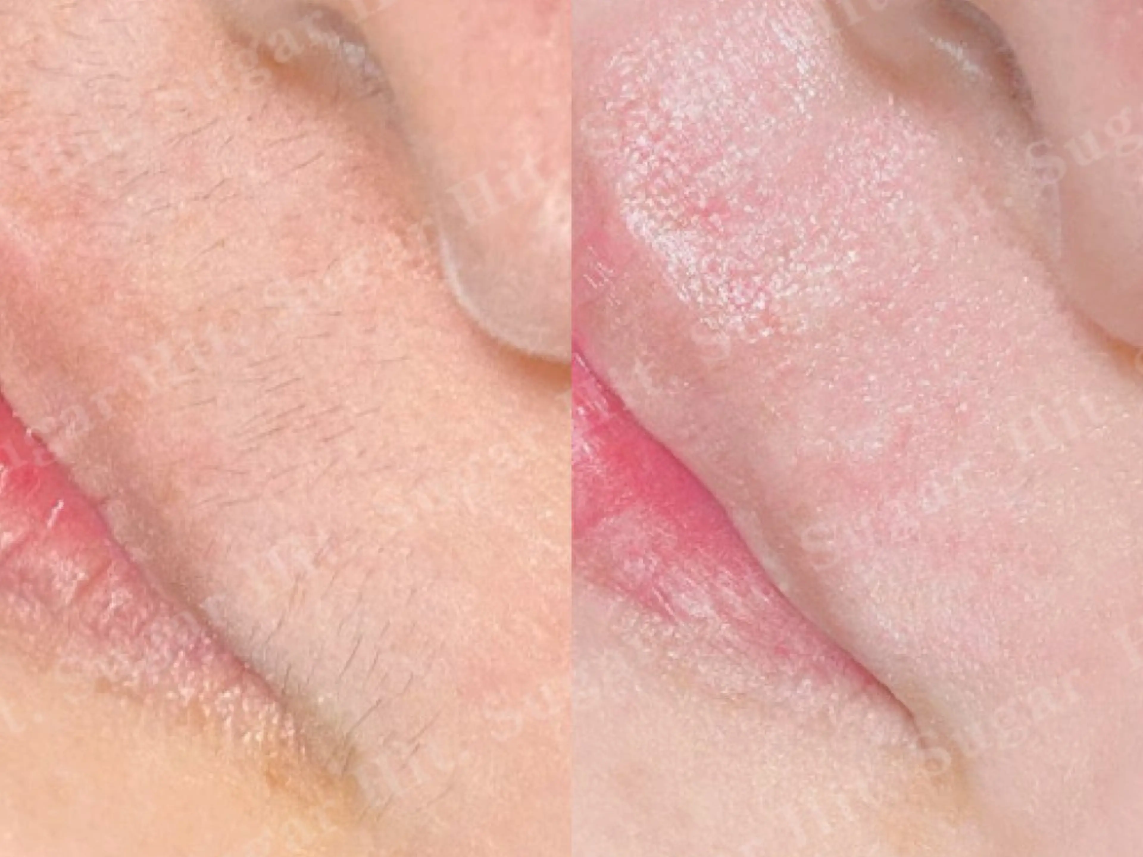 Hit. シュガーリング豊橋のエステ・リラクイメージ