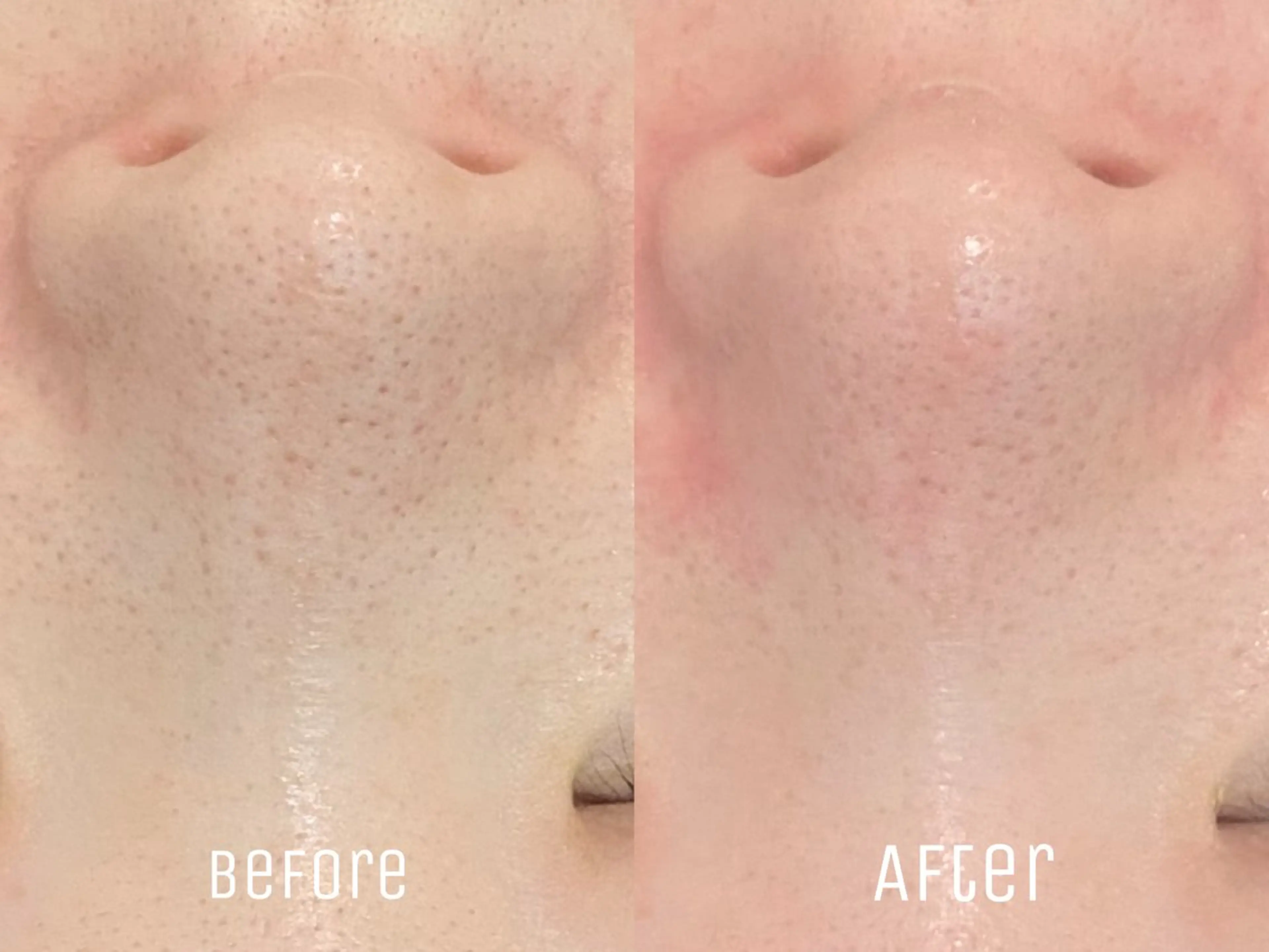 エステ ニキビ・毛穴・肌荒れ &me 西宮北口店のその他イメージ