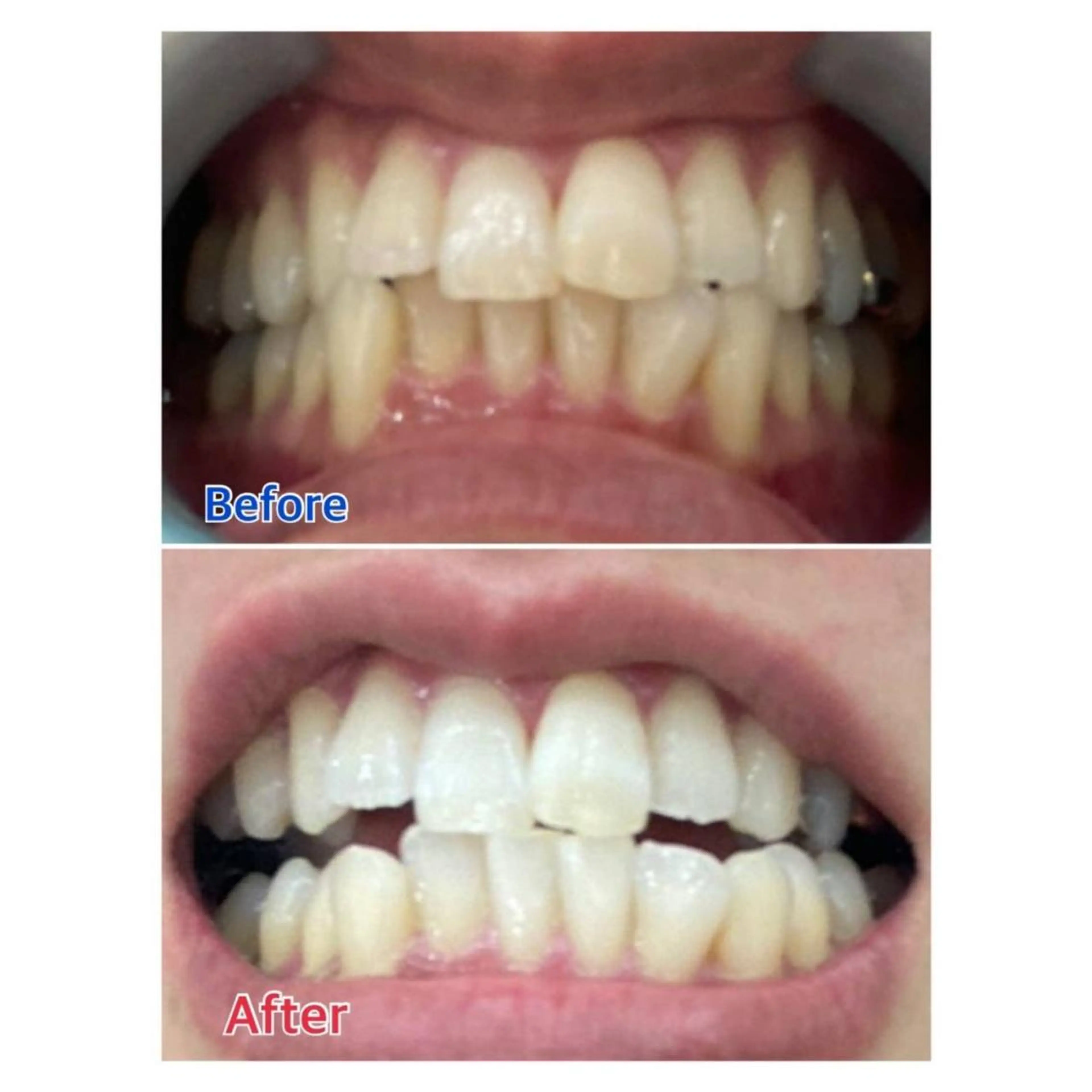 MBEAUTYSALON 千葉店・京成大久保所属・Melty 輝のその他イメージ