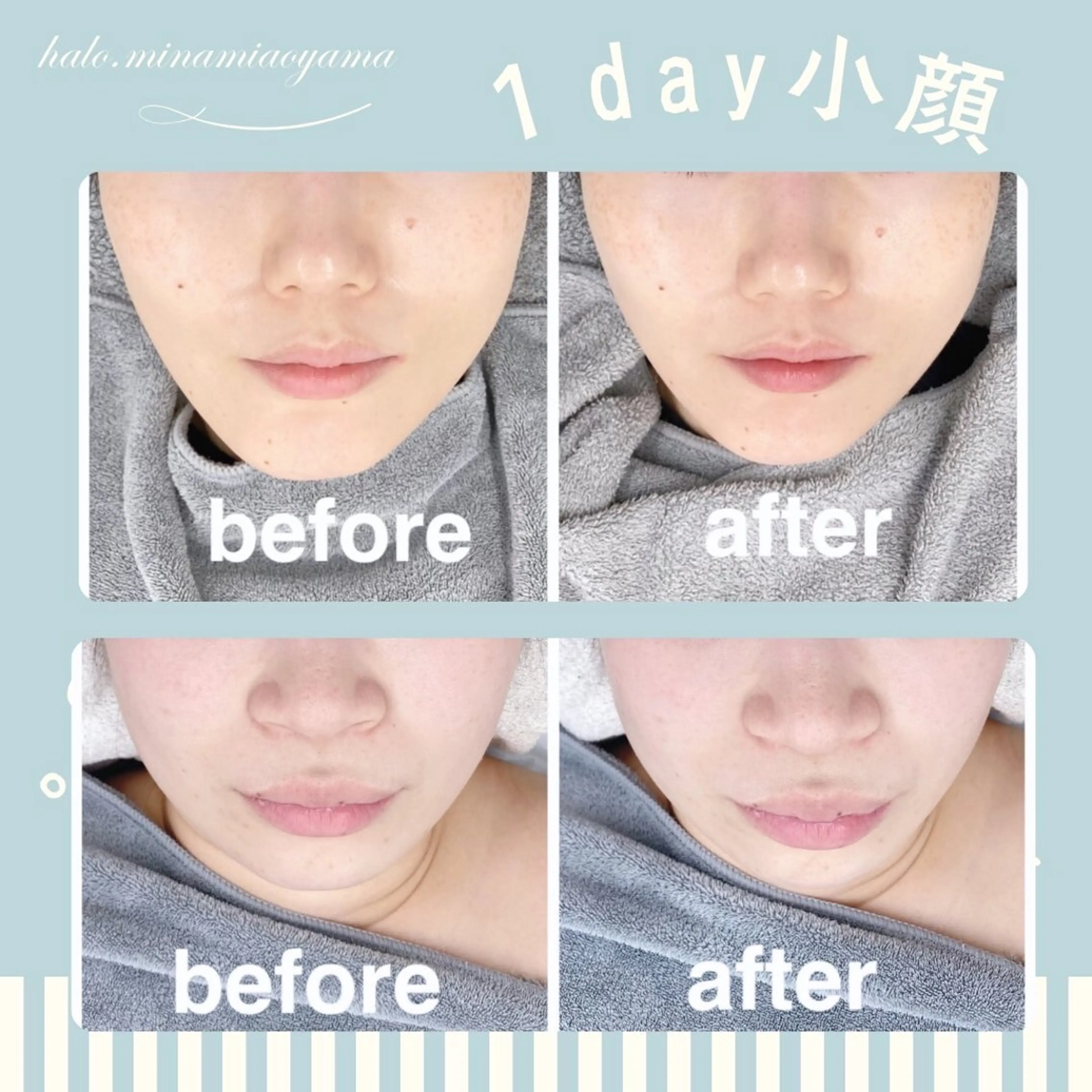 【８０分】全顔三層☆小顔リフトアップフェイシャル5,000sの写真