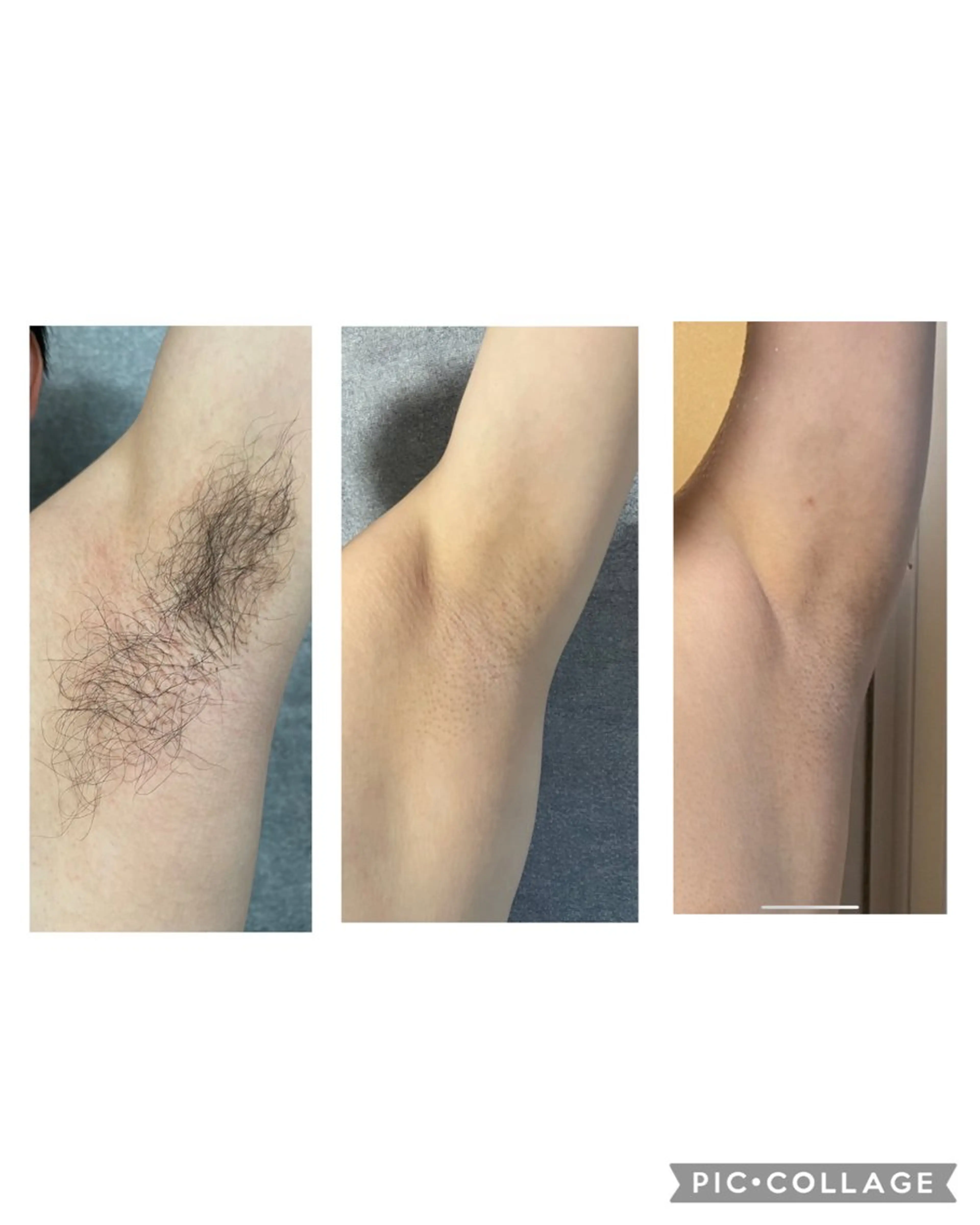 RE:moom リムーム/脱毛エステのエステ・リラクイメージ