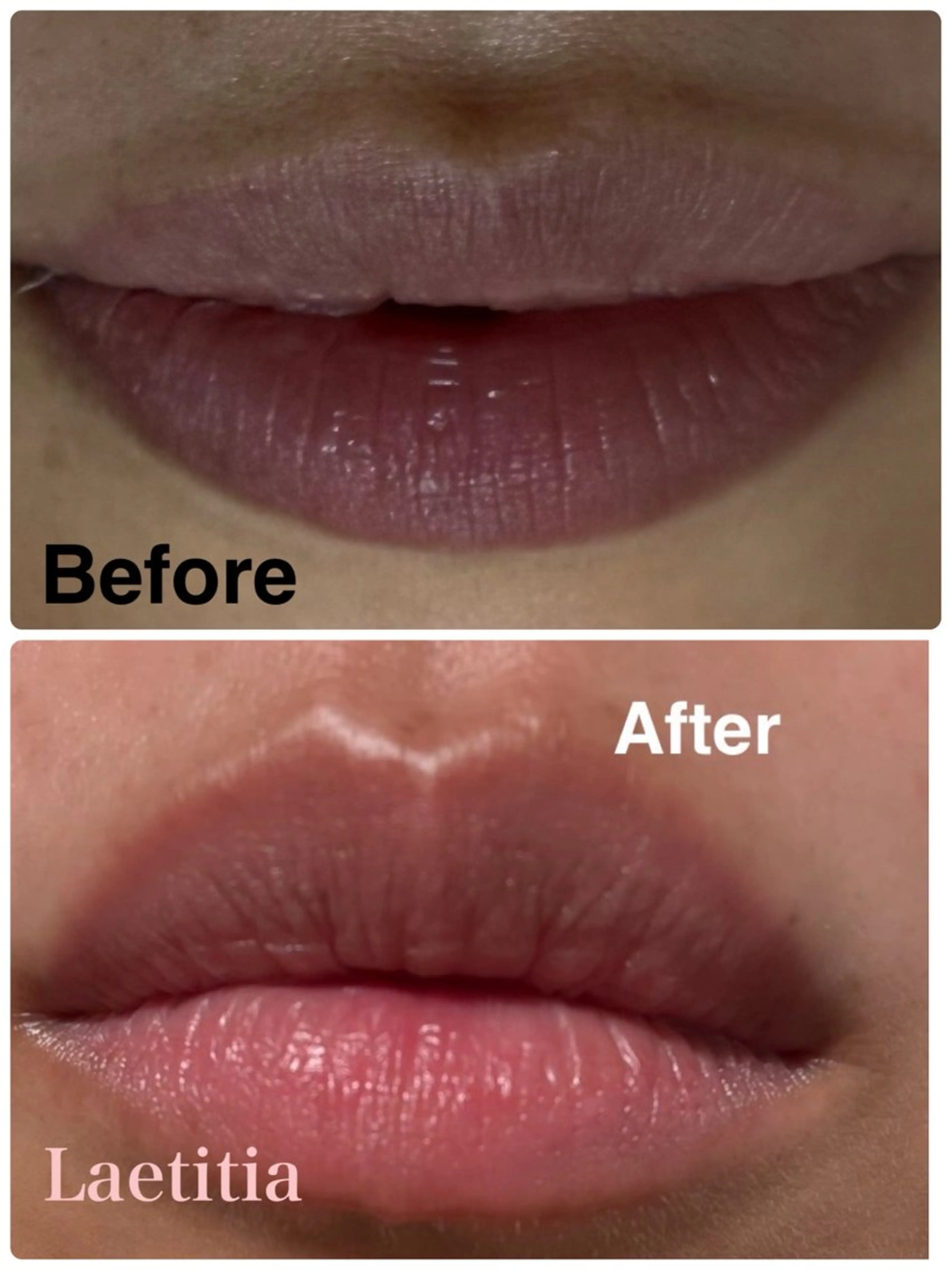 レティティア【Laetitia】所属・レティティア秋葉原店 Yoshizawaのエステ・リラクイメージ