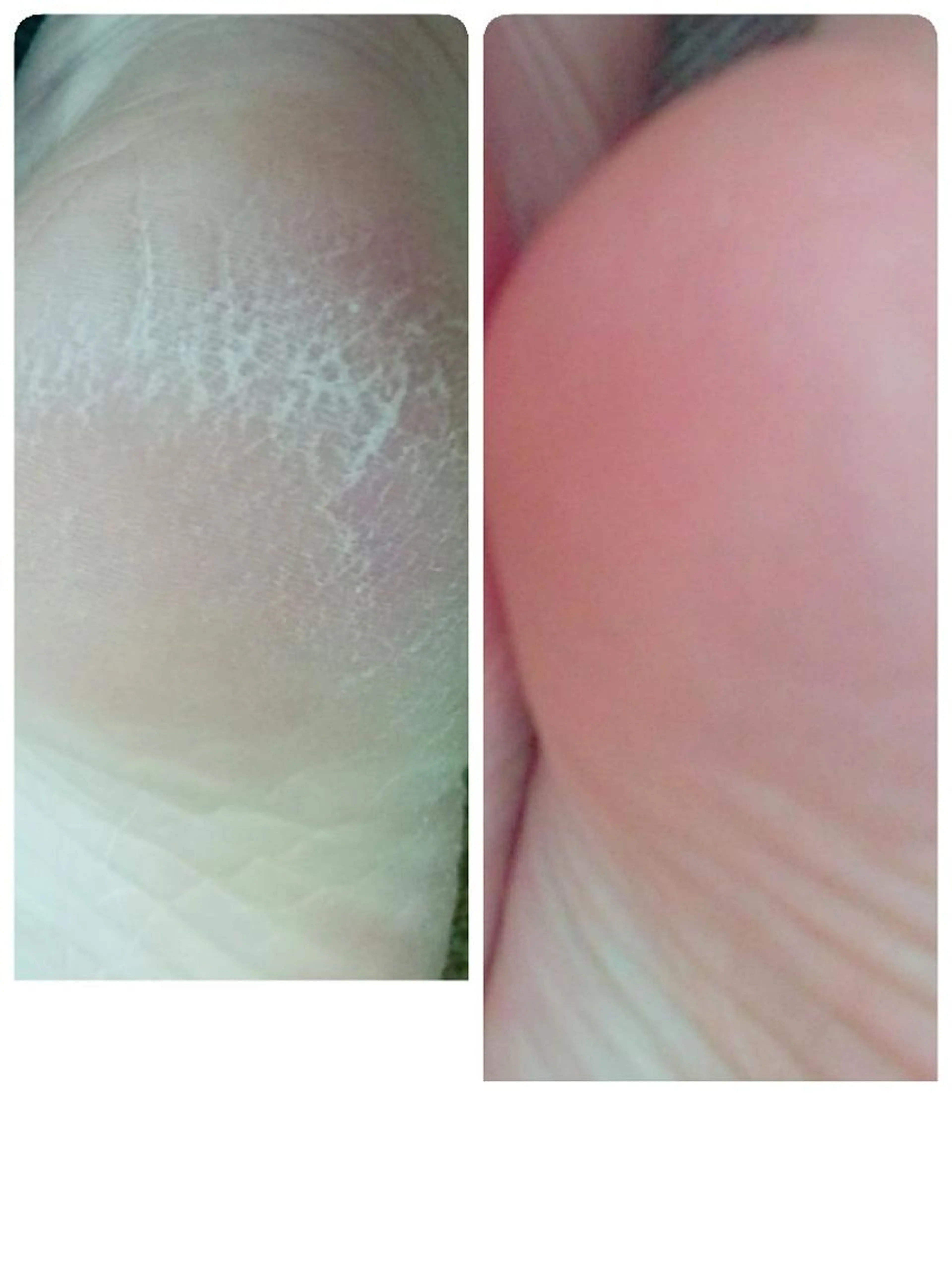 足裏ぷるぷるケアの写真