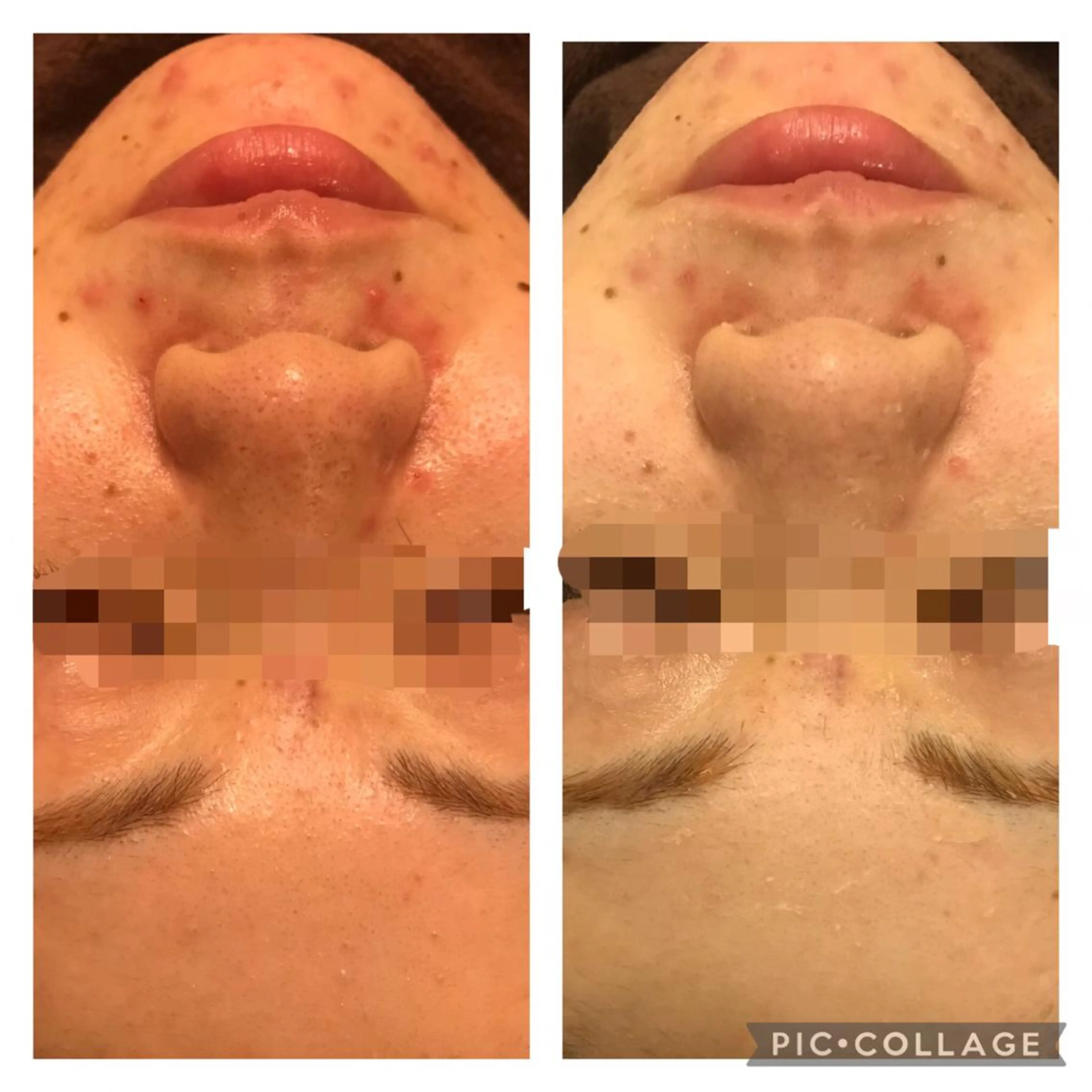 ミディアム カラー パーマ ヘアアレンジ メンズ キッズ ネイル マツエク・マツパ アニメ,Vオタク× 即効痩せエステサロンのエステ・リラクイメージ