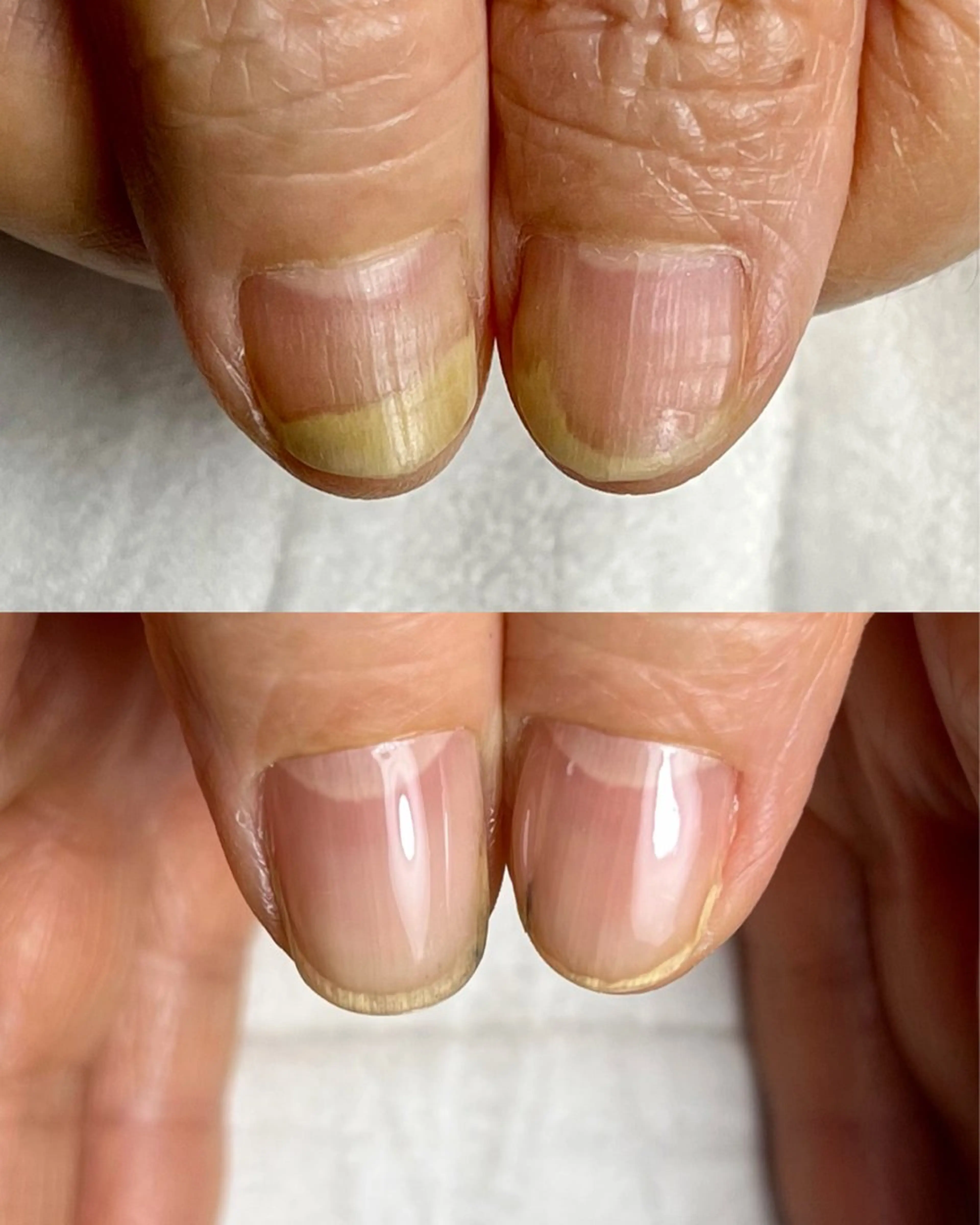 ネイル 佐藤 光のネイルデザイン