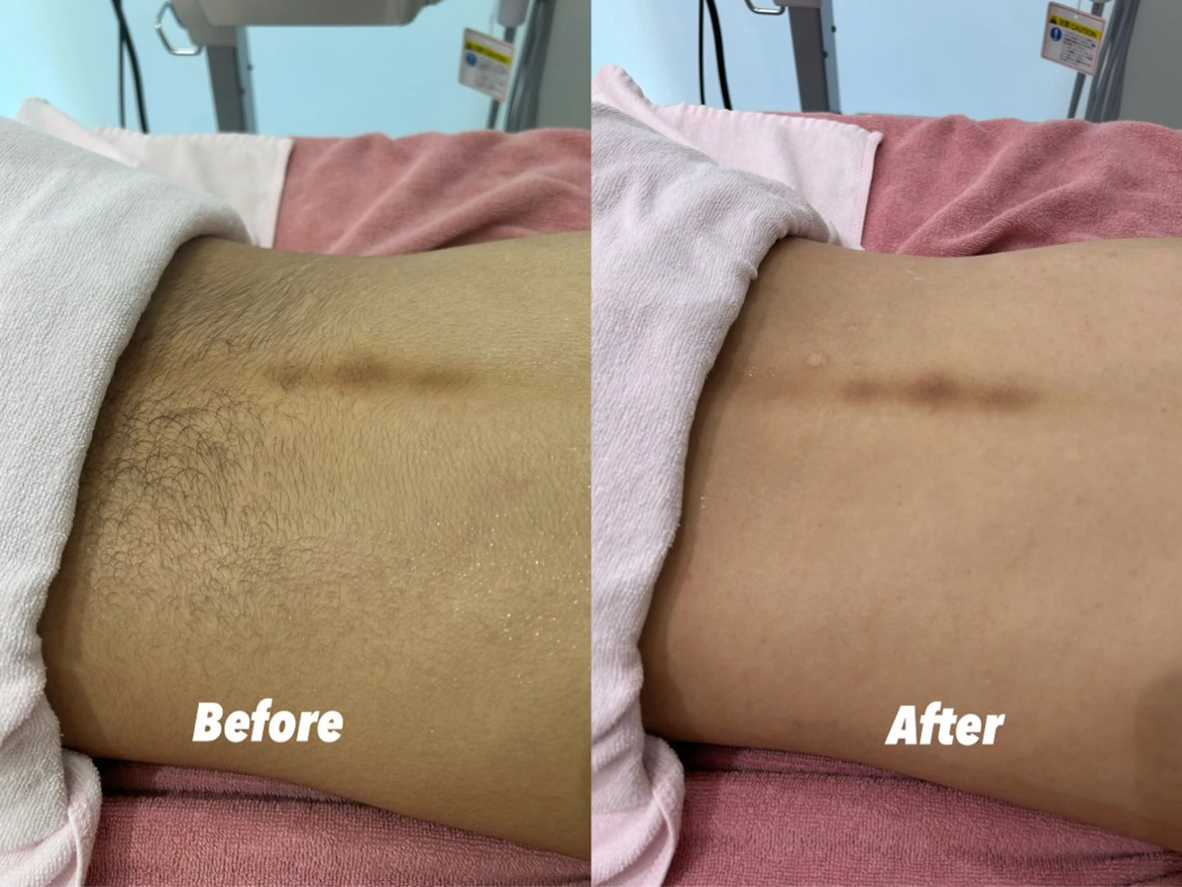 その他 🫧美しい素肌へ🫧 今成柚乃のその他イメージ