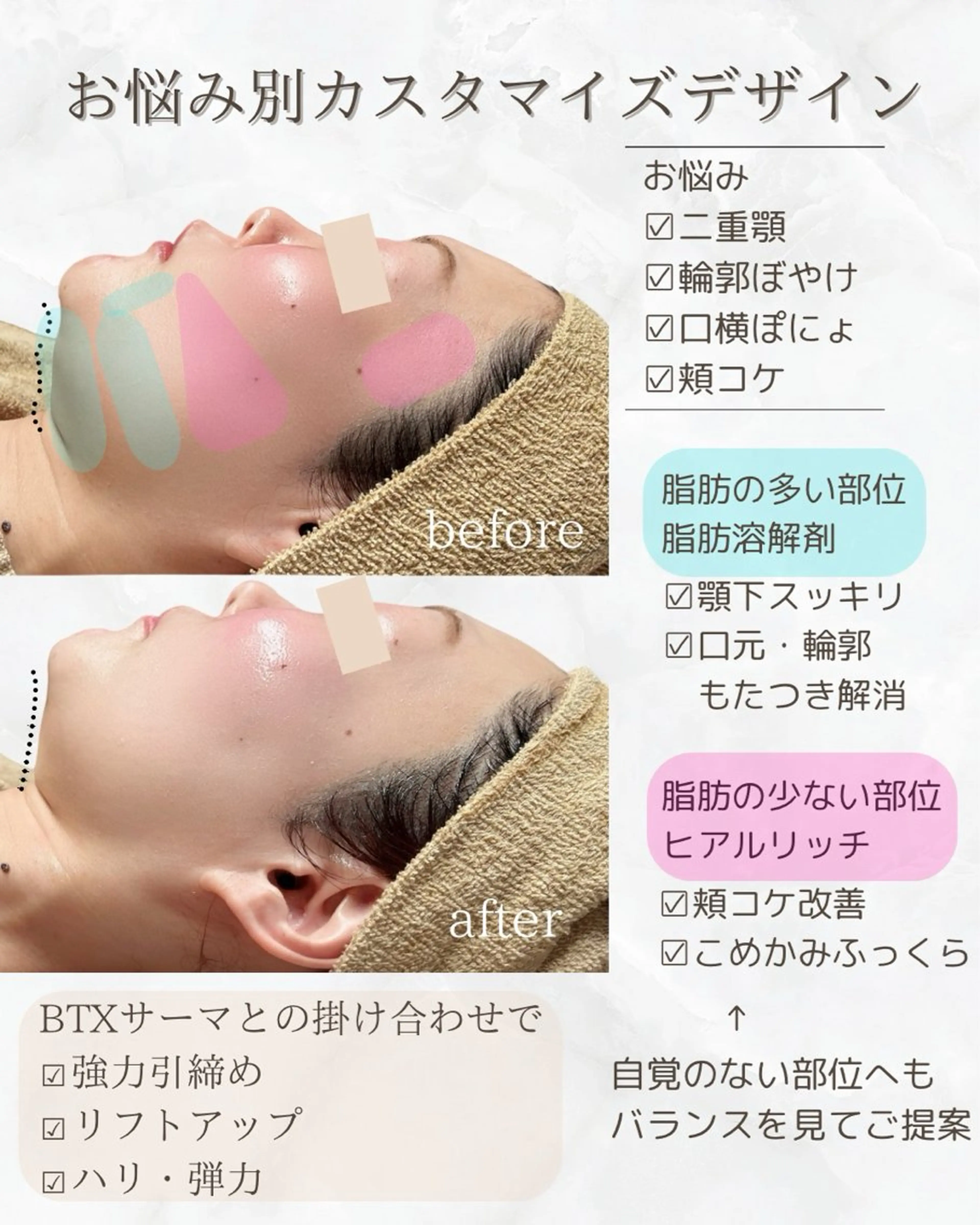 小顔専門看護師クリニカルサロンCOCO所属・小顔と美肌サロン クリニカルサロンココのエステ・リラクイメージ