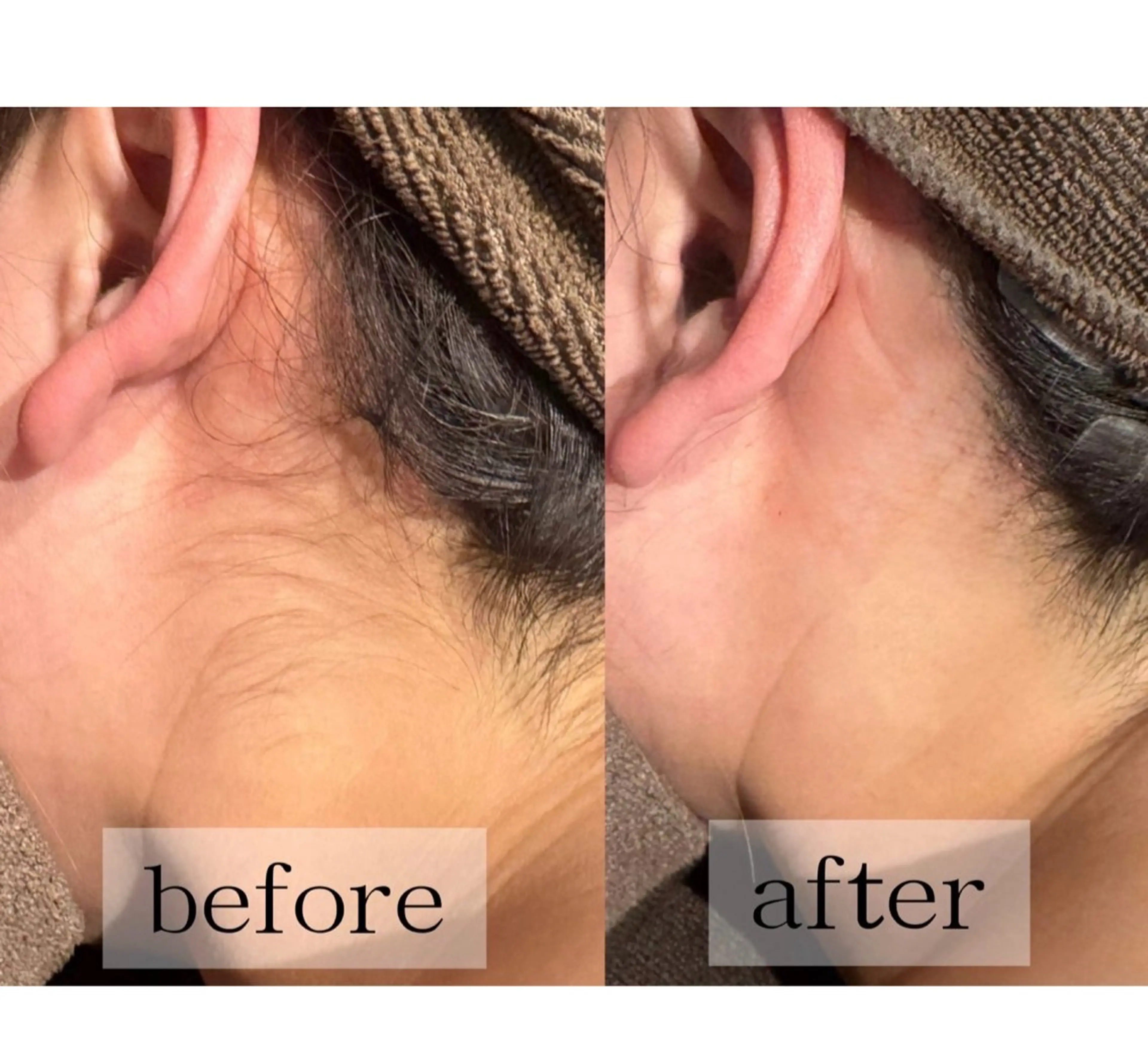 脱毛 毛穴、肌質ケア専門 グランビューティのエステ・リラクイメージ