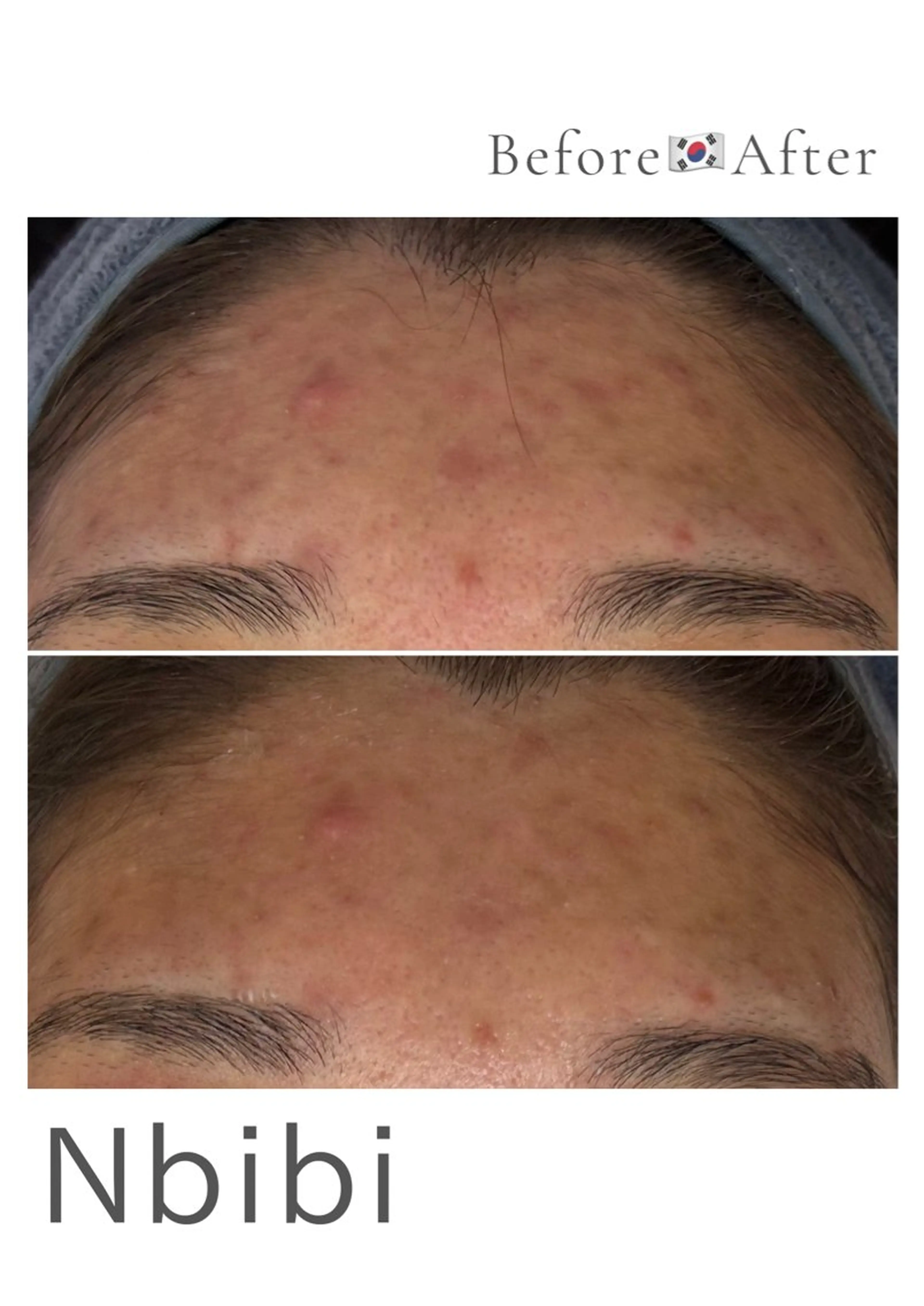 韓国🇰🇷価格 サロン_Nbibiのエステ・リラクイメージ