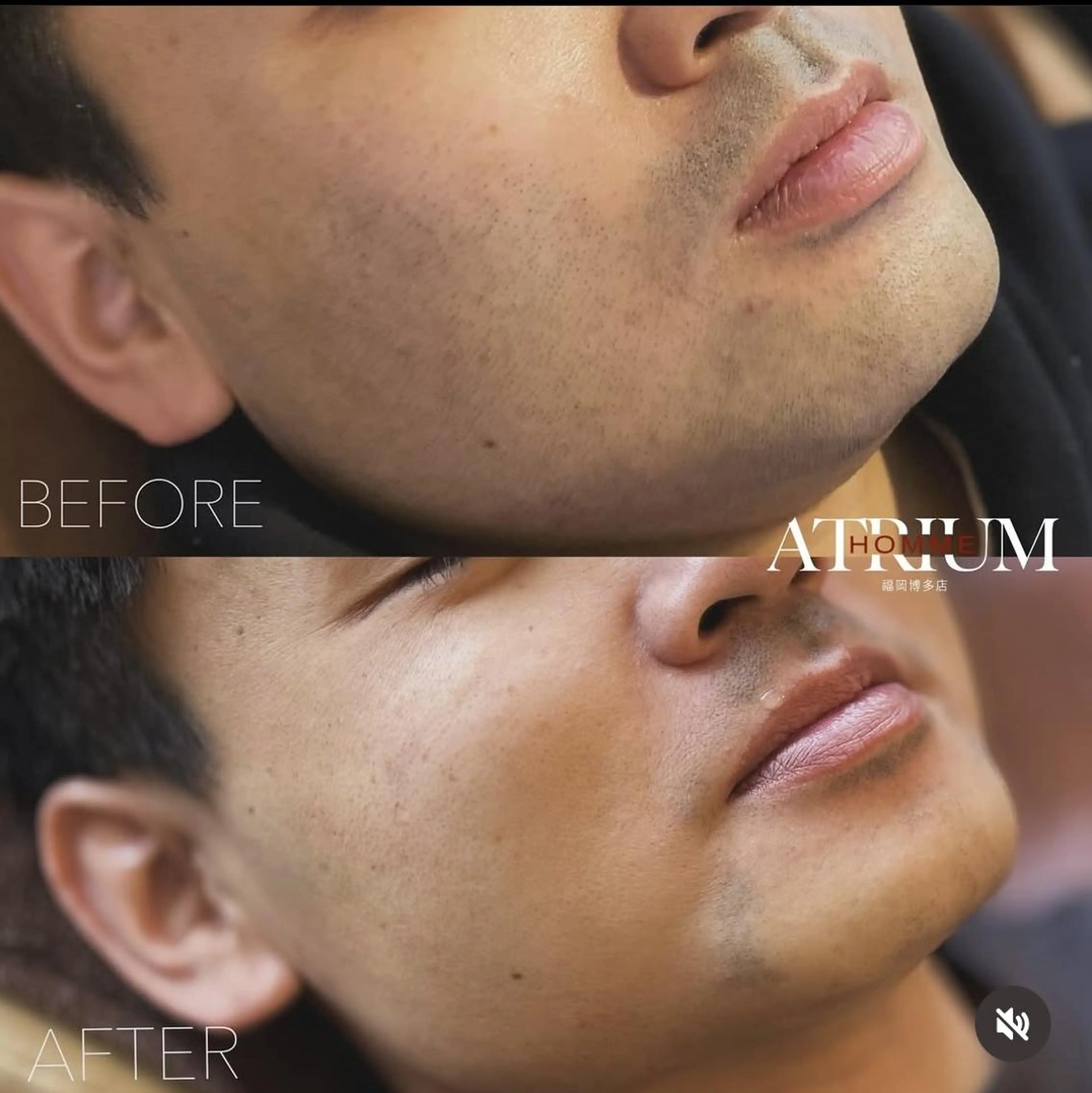 メンズ 脱毛 ATRIUM HOMME 博多の眉毛・アイブロウイメージ