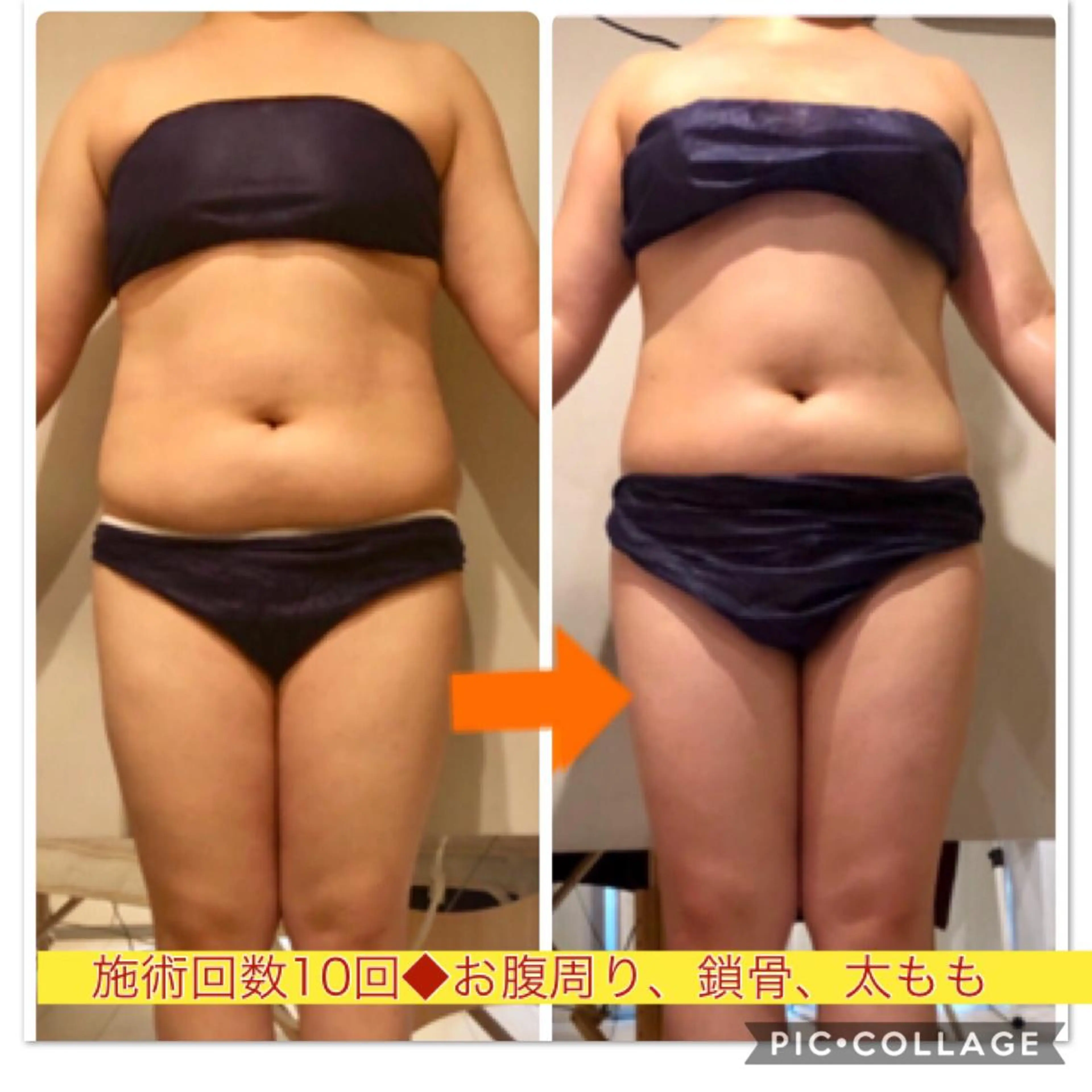 ショート カラー パーマ ヘアアレンジ メンズ キッズ ネイル マツエク・マツパ ‍痩身＆ボディ 結果出し🌟丹野のエステ・リラクイメージ