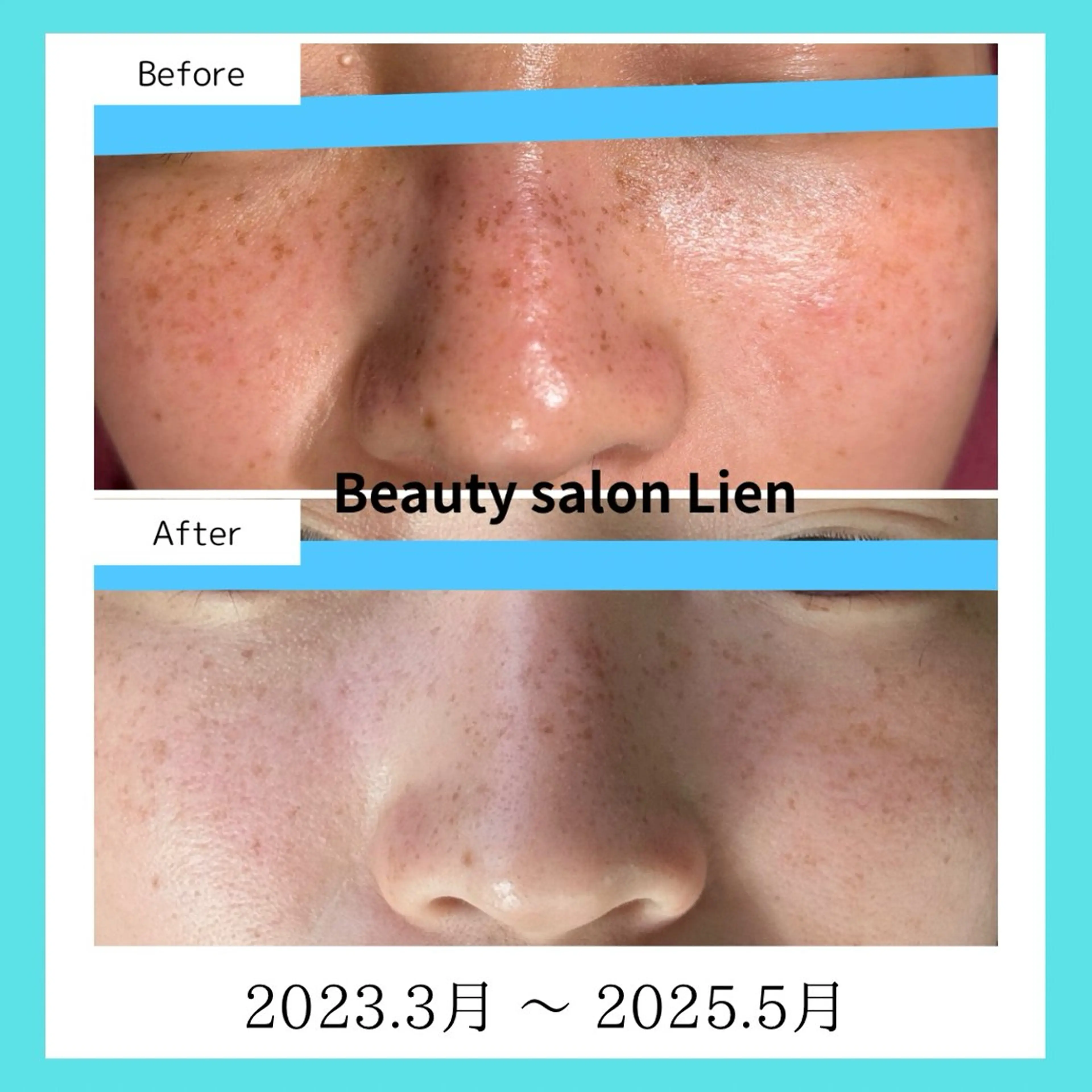 Beauty  salon Lien所属・大村市Lien＊ 中川内翔子のエステ・リラクイメージ