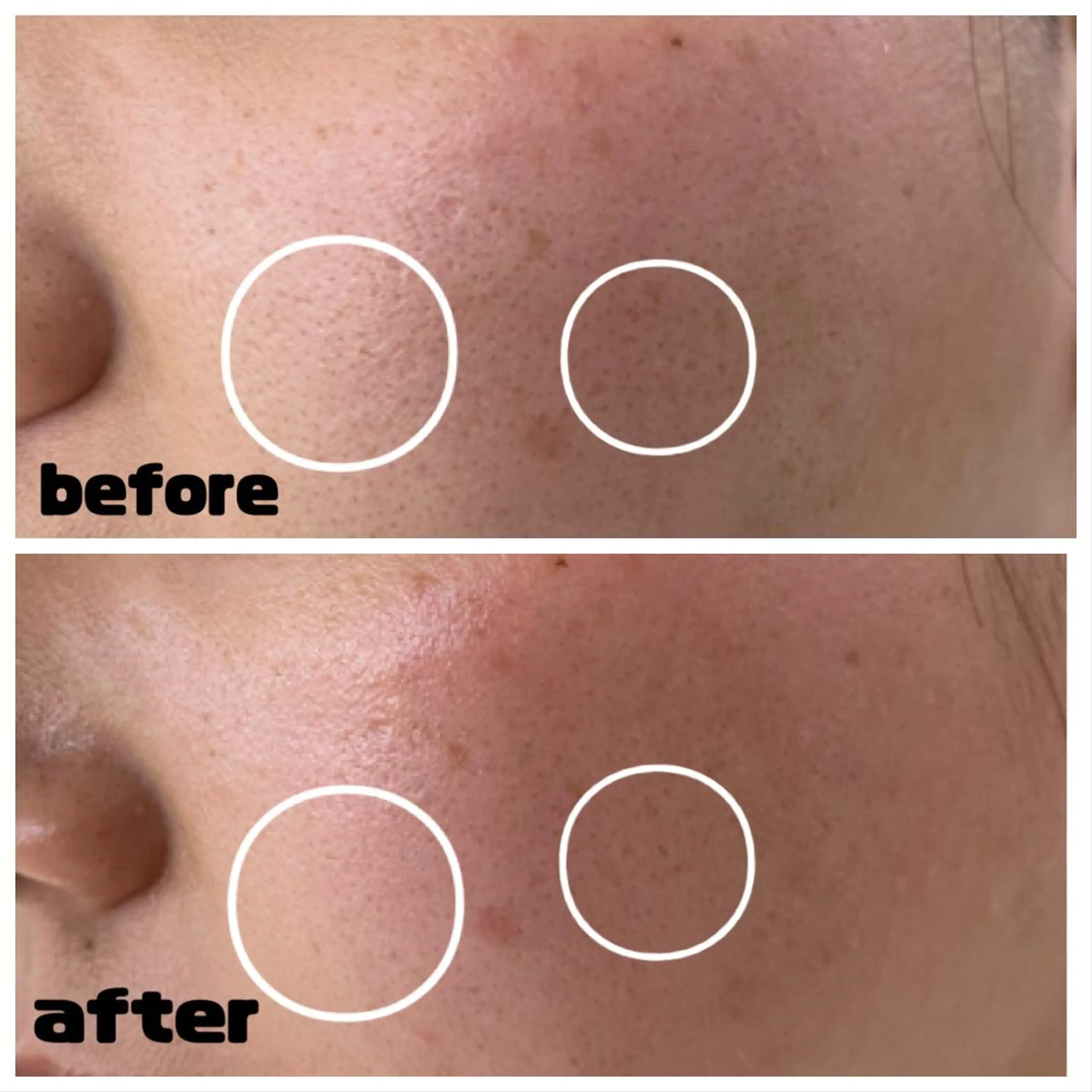 デ・アイム新潟北所属・サイトウ .のエステ・リラクイメージ