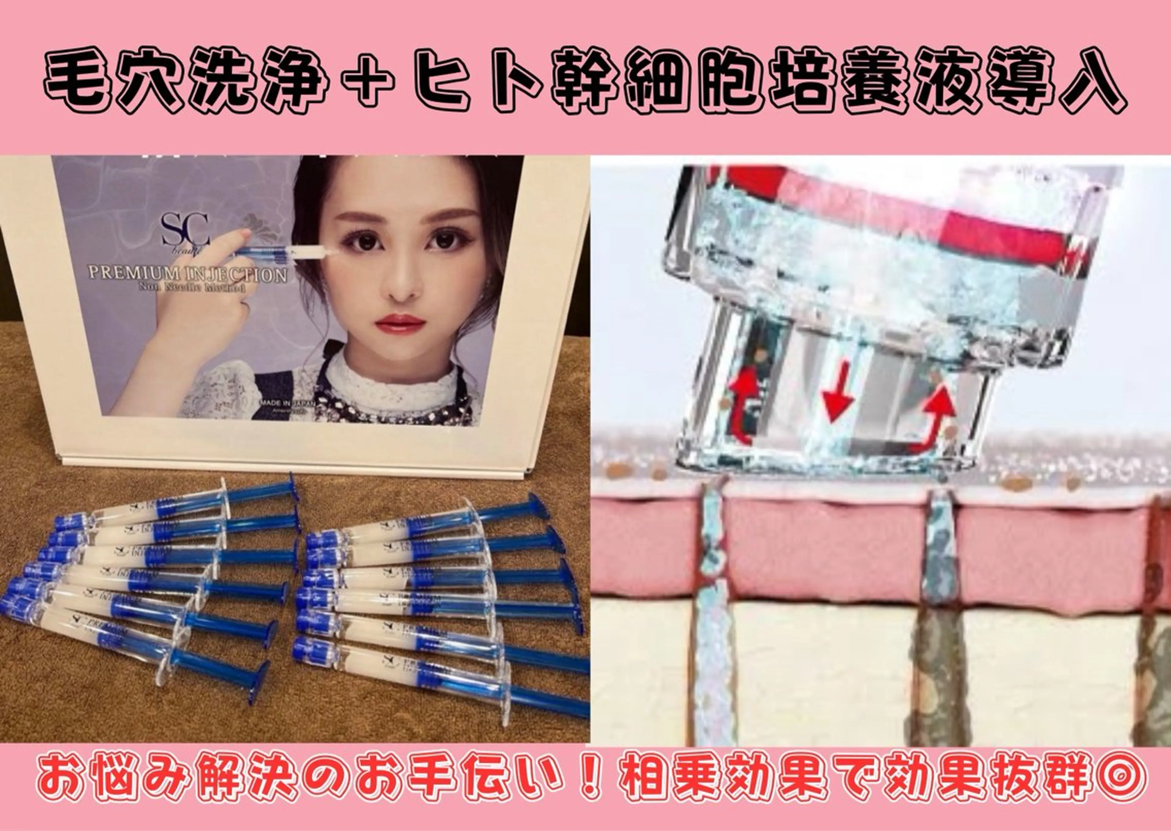 【ミニミ価格】毛穴洗浄＆マイクロニードル美容液導入75分コース☆毛穴汚れを徹底洗浄・美容液導入でリフトUP効果も絶大！の写真