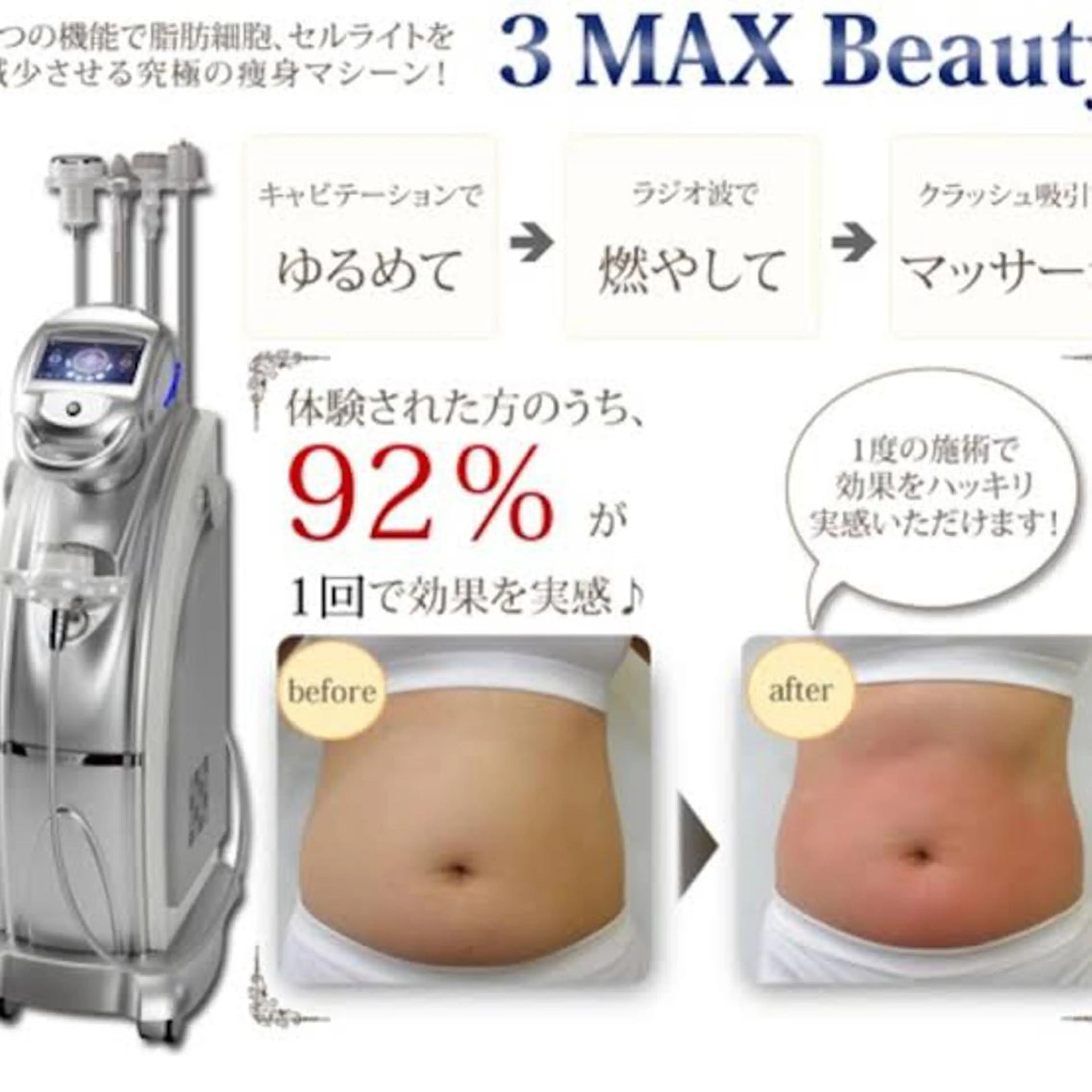 💕機械三つの組み合わせ❤️3max30分痩身マシン🌹💫一回でも驚きの効果🎉の写真