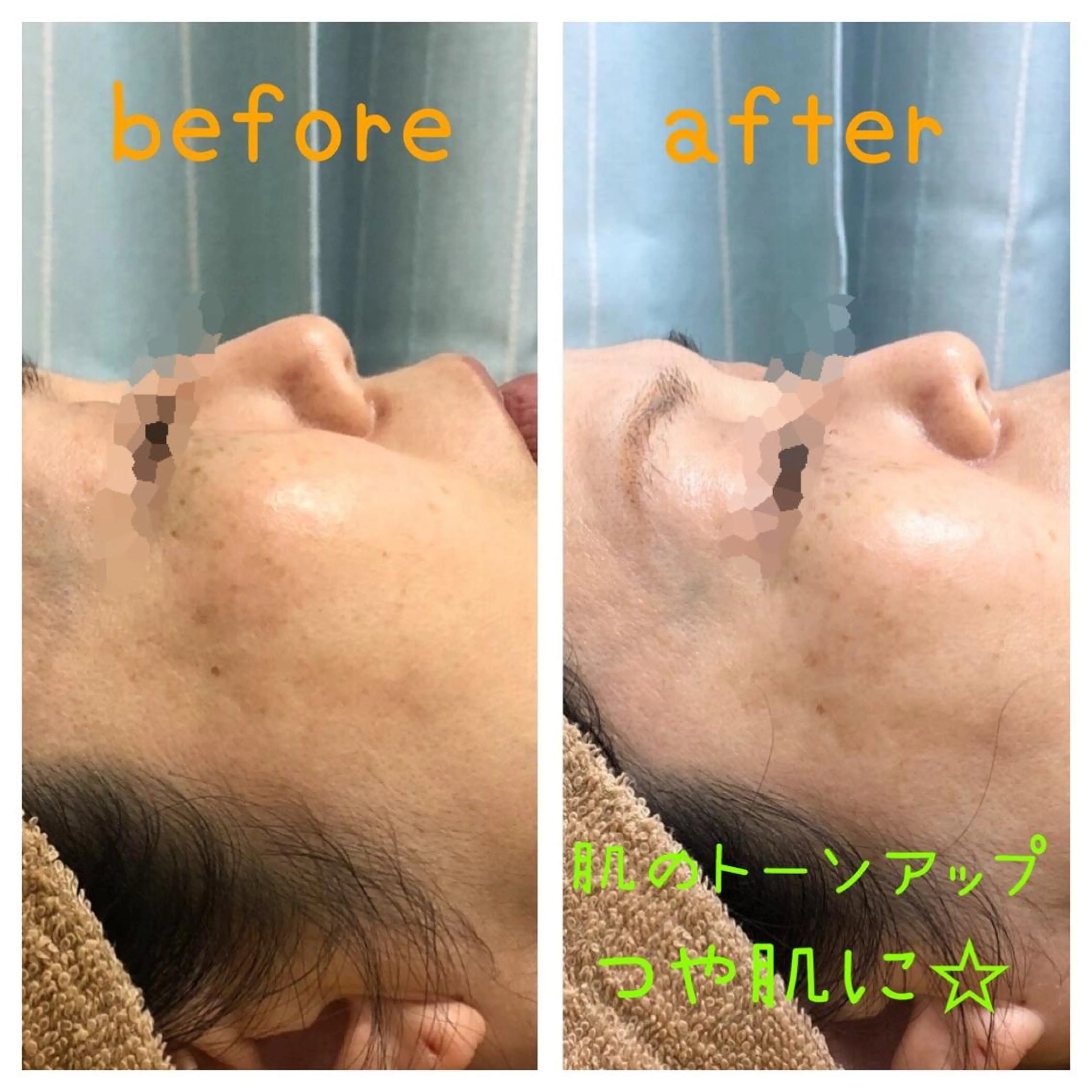 たにがわ整骨院　　salon  de  epila所属・salon   de epilaのエステ・リラクイメージ