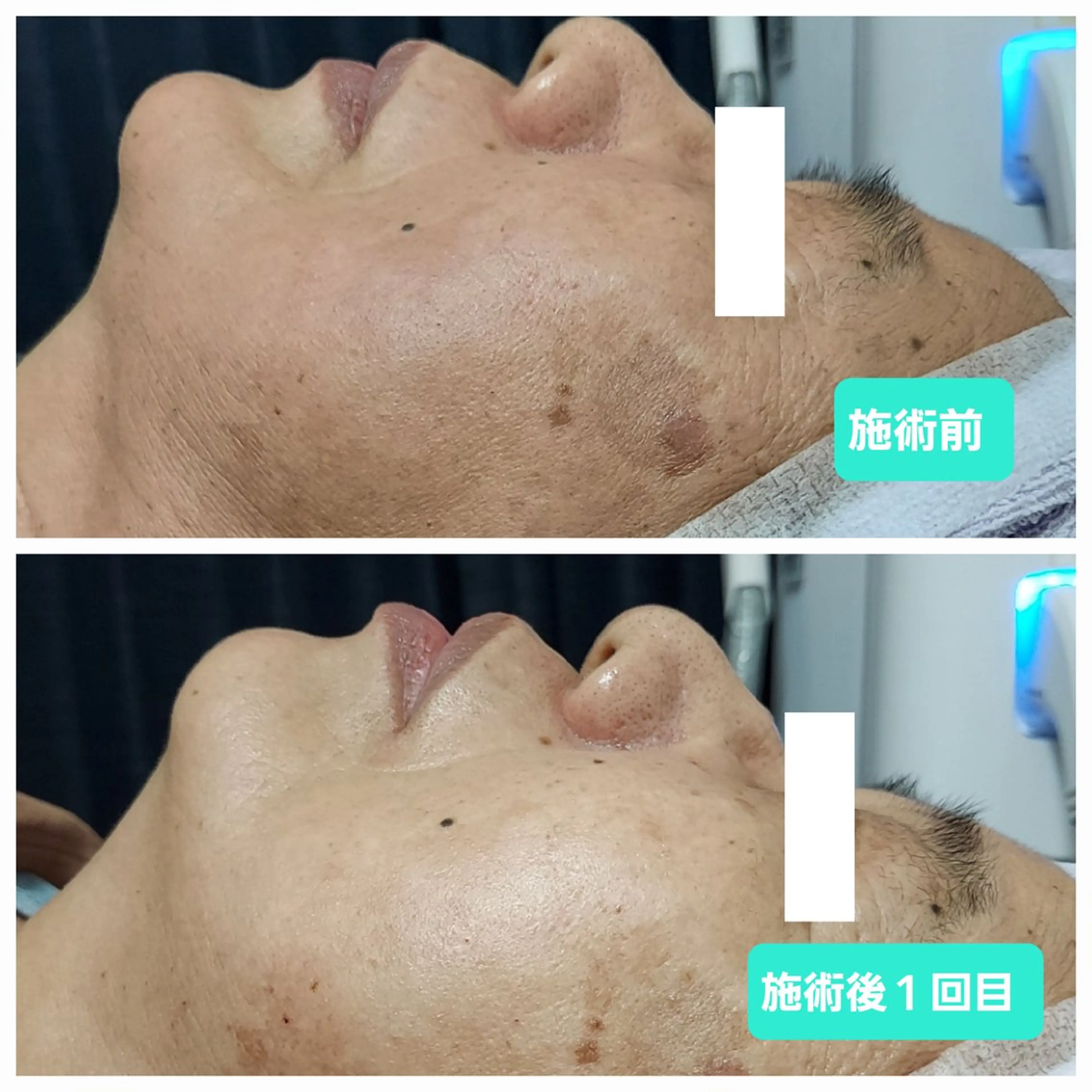 脱毛 プライベートサロン Avenirのエステ・リラクイメージ