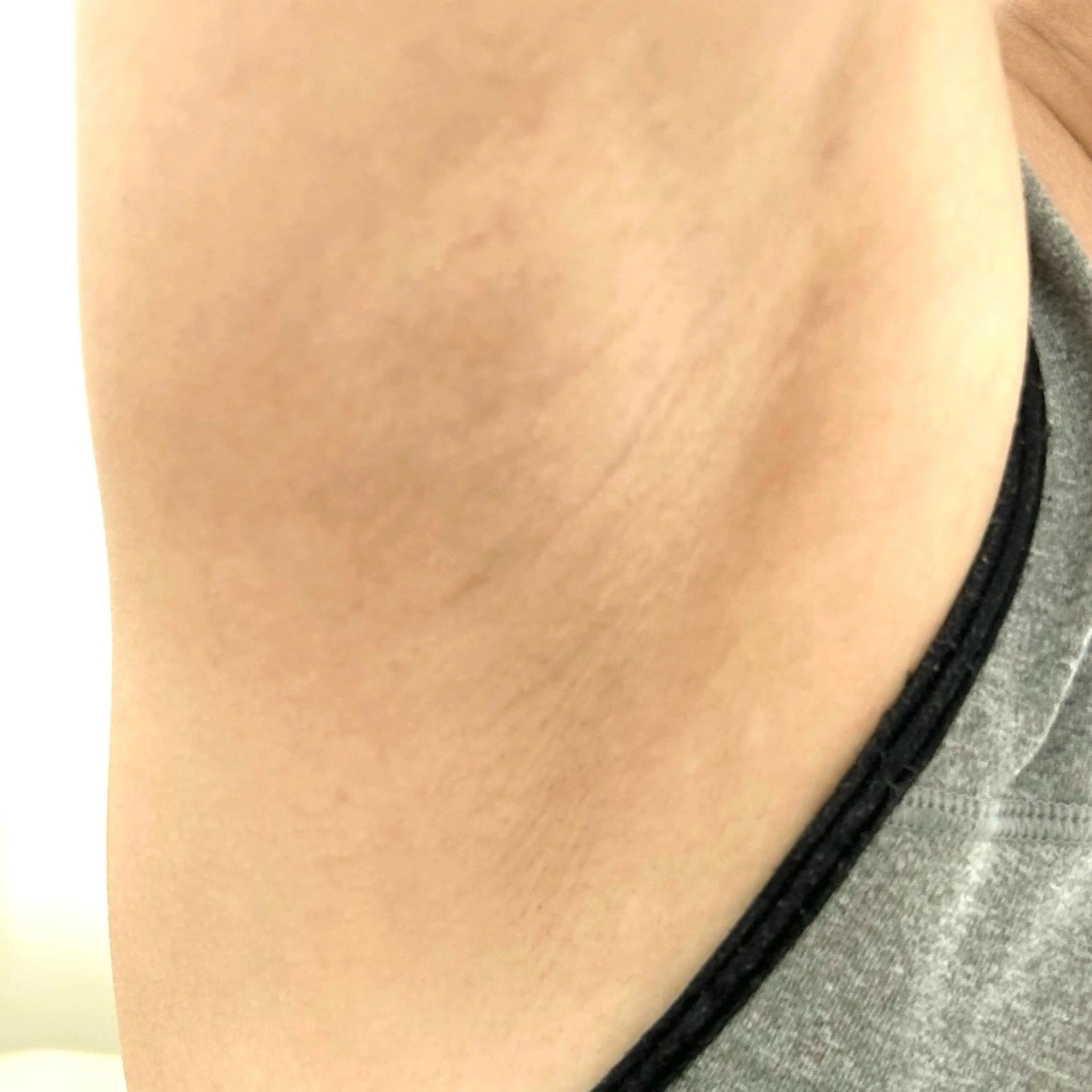 【女性限定】初回両ワキ＋お好きな部位脱毛¥2000の写真