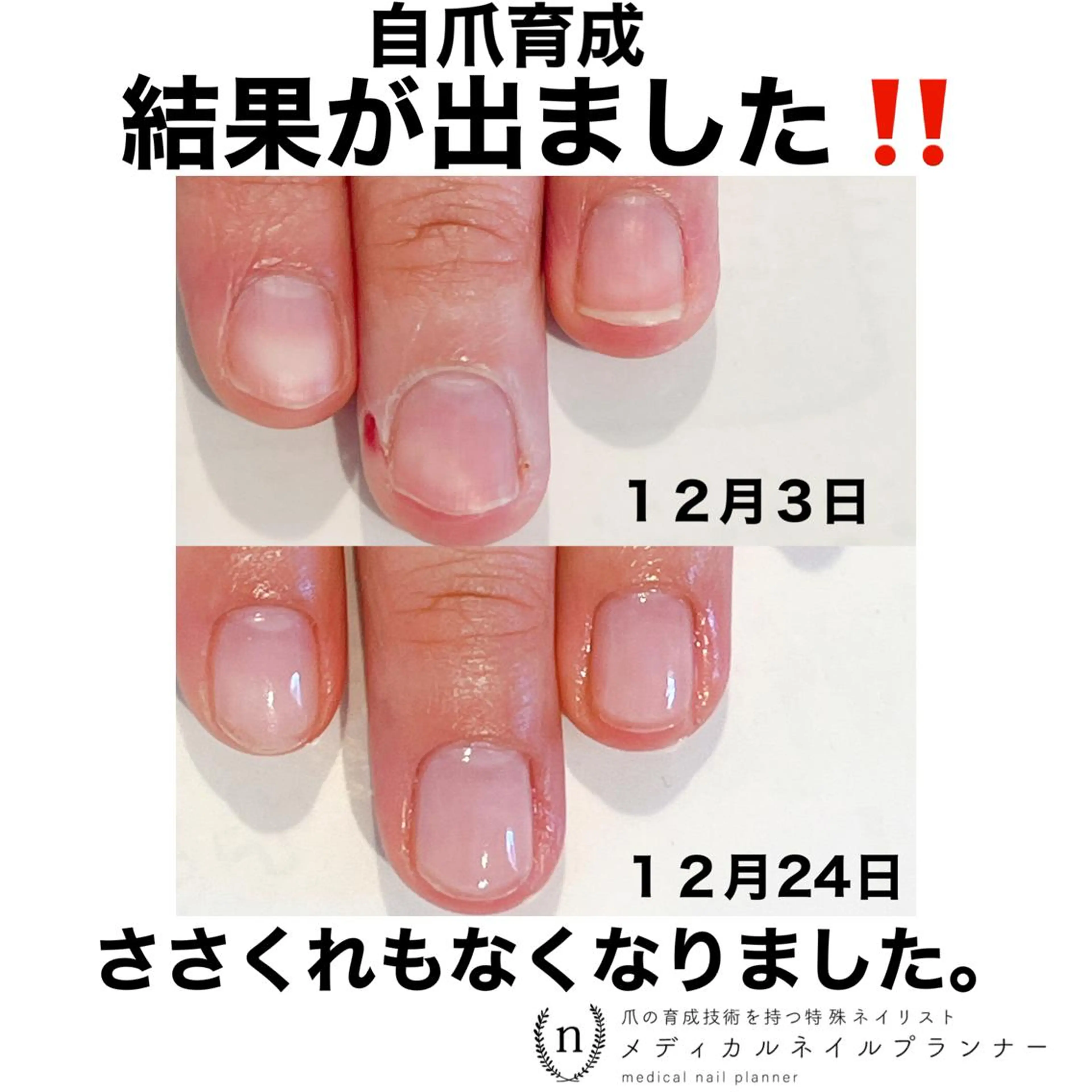 ネイル NAIL SALON ｔｏｇｇｙのネイルデザイン