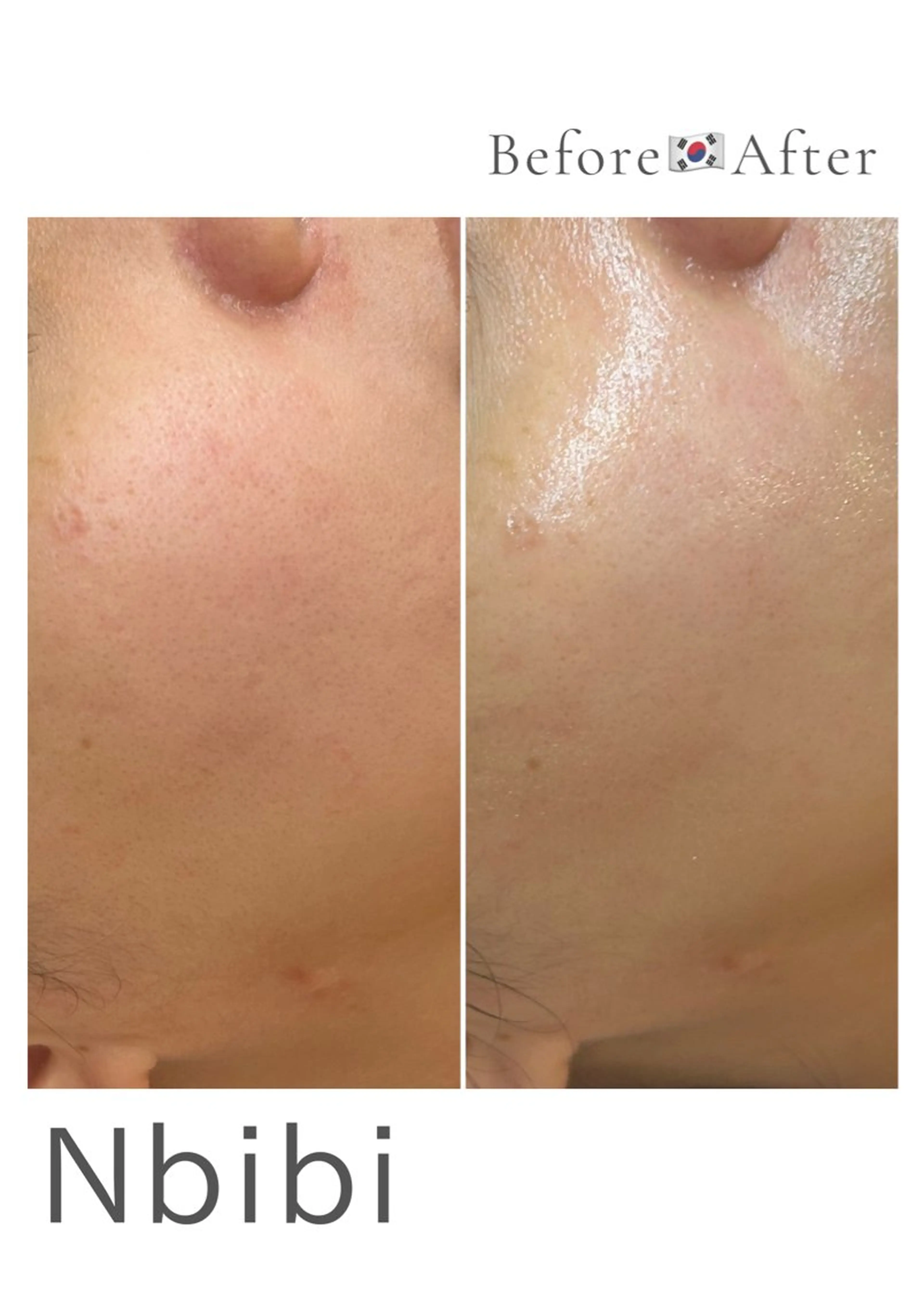 韓国🇰🇷価格 サロン_Nbibiのエステ・リラクイメージ