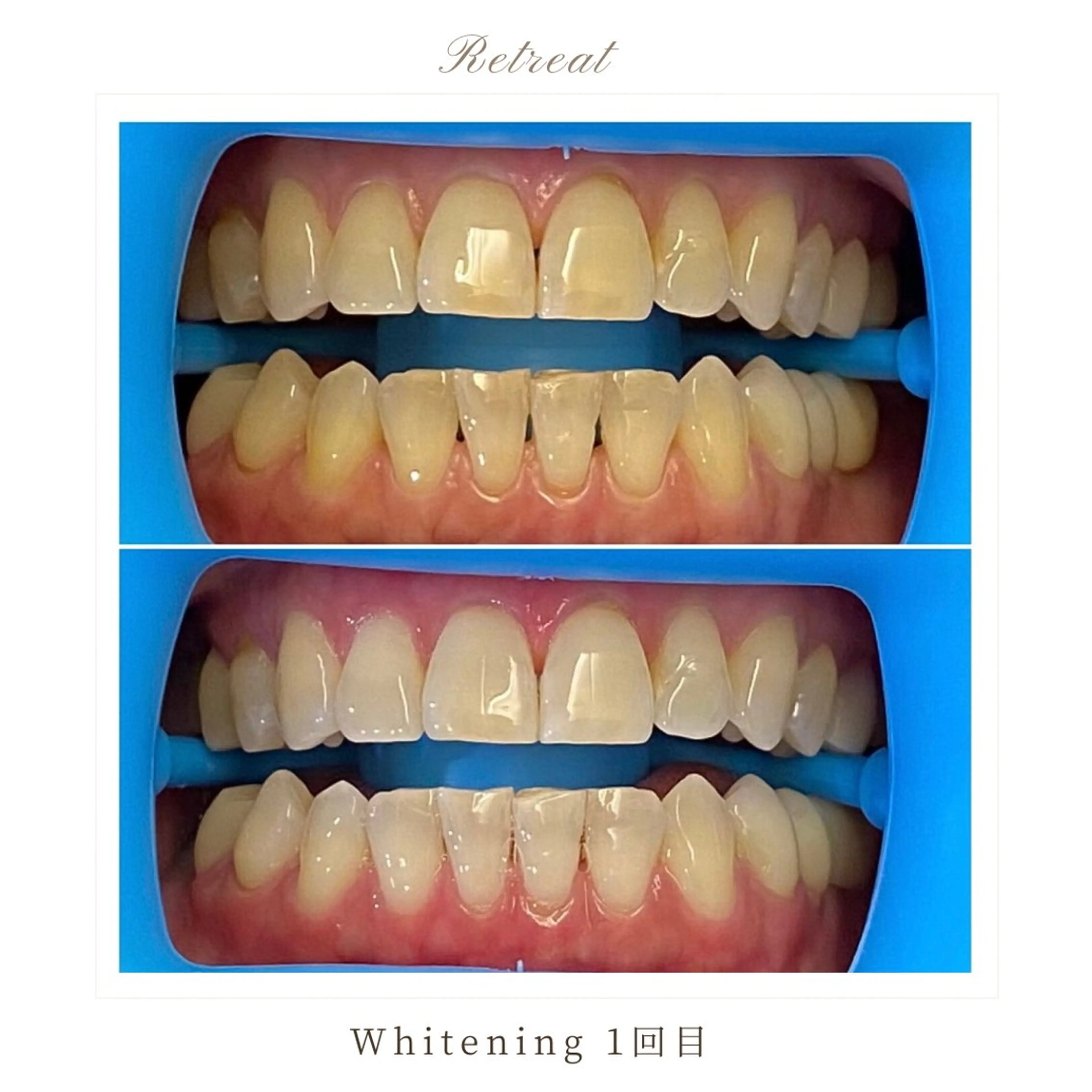 Retreatリトリート所属・歯科医院提携 Retreatのエステ・リラクイメージ