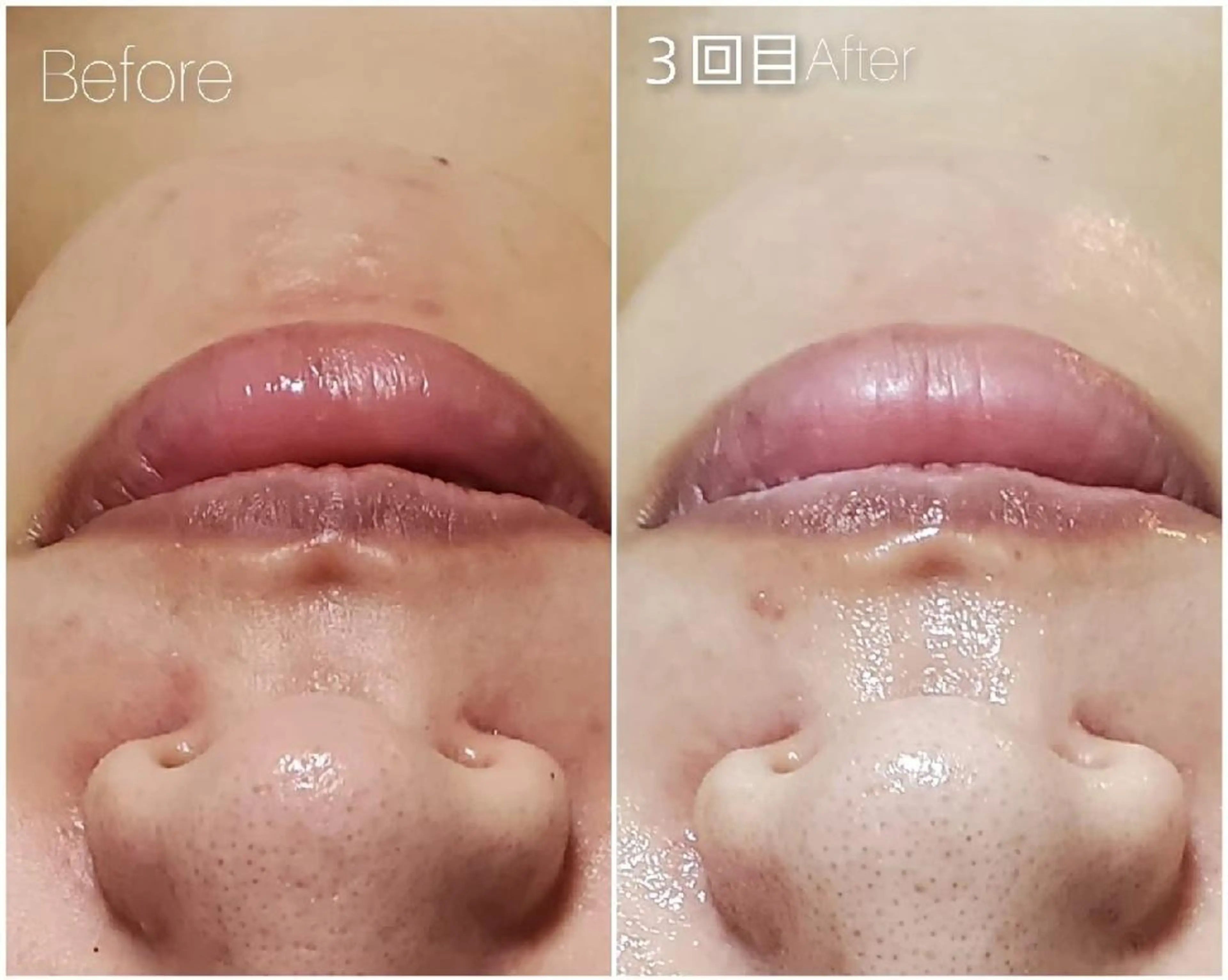 エステ ALOHA RETREATのエステ・リラクイメージ