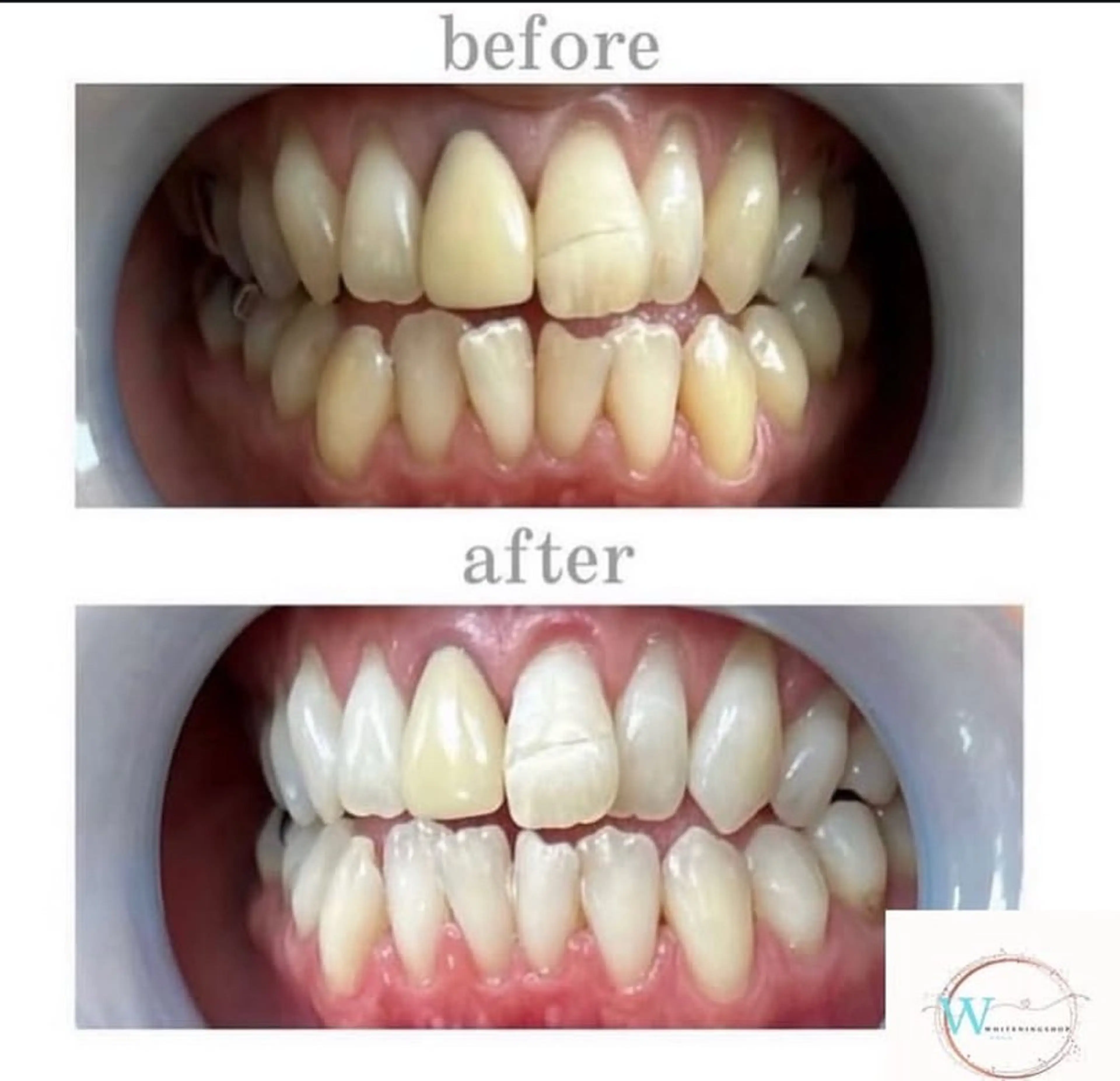 ホワイトニング ショップ本厚木のその他イメージ