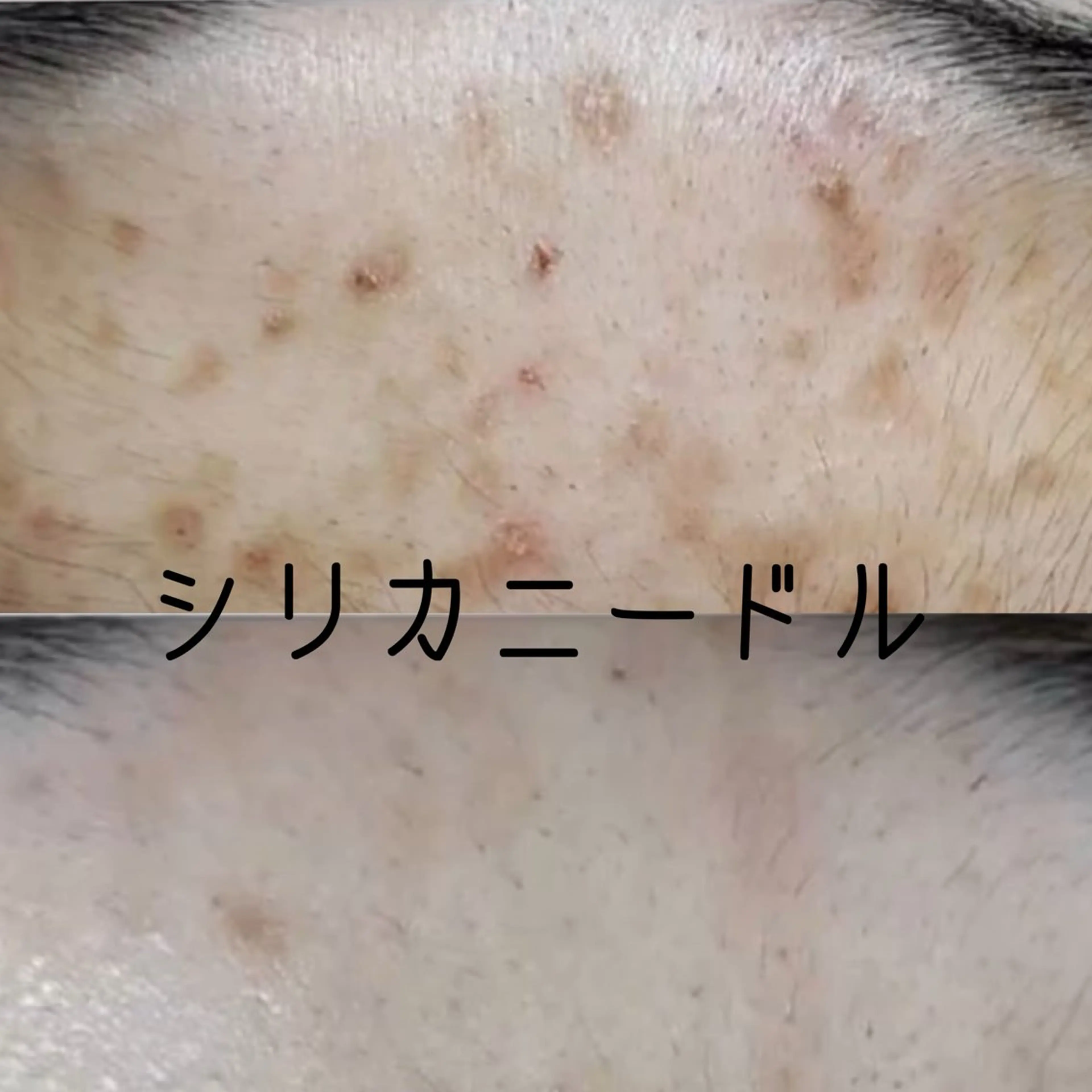 エステ リラク 目元・まつパ・美肌フ ェイシャル谷町四丁目のマツエク・マツパデザイン