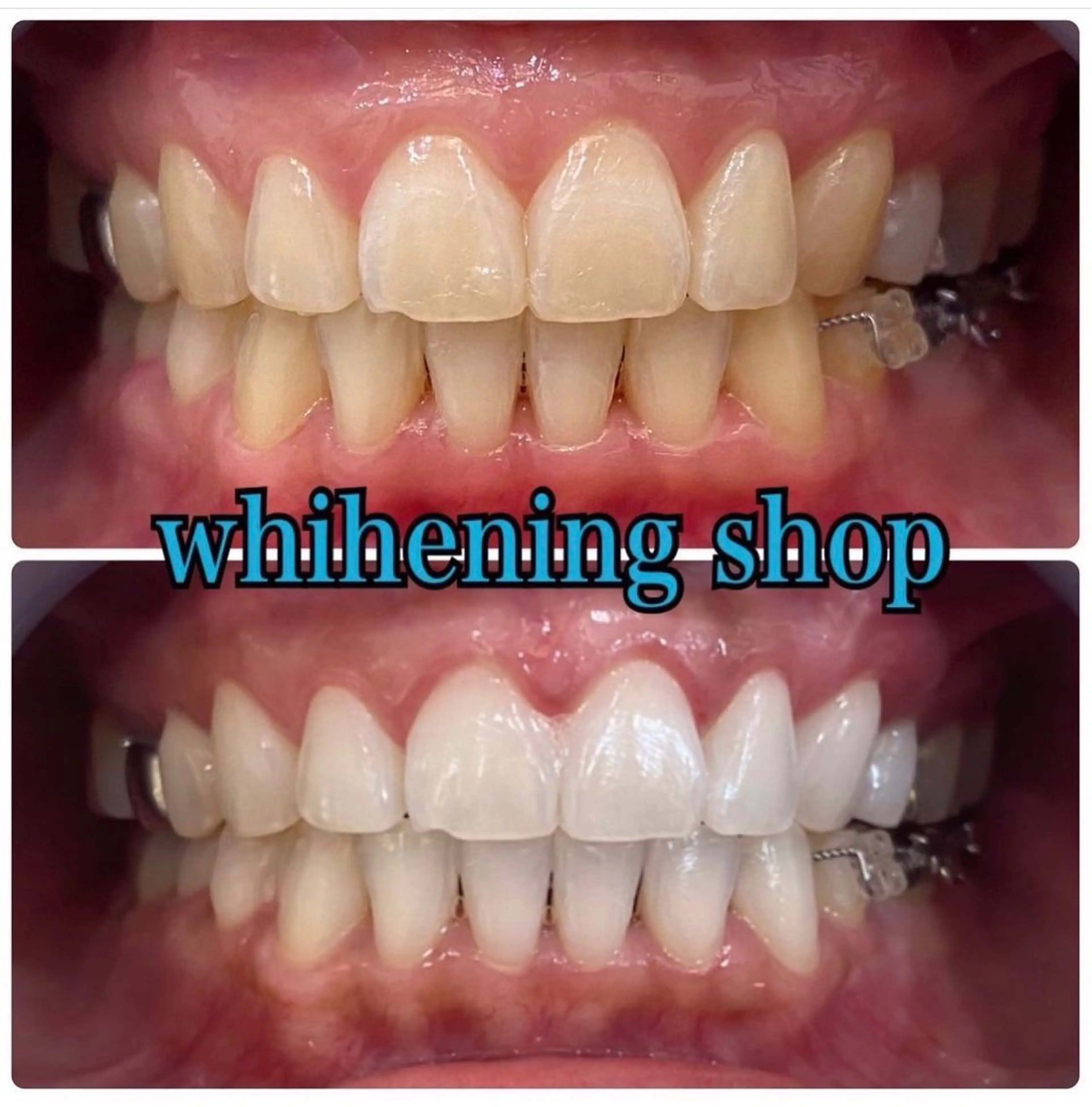 エステ リラク ホワイトニング ショップ吉祥寺店のエステ・リラクイメージ