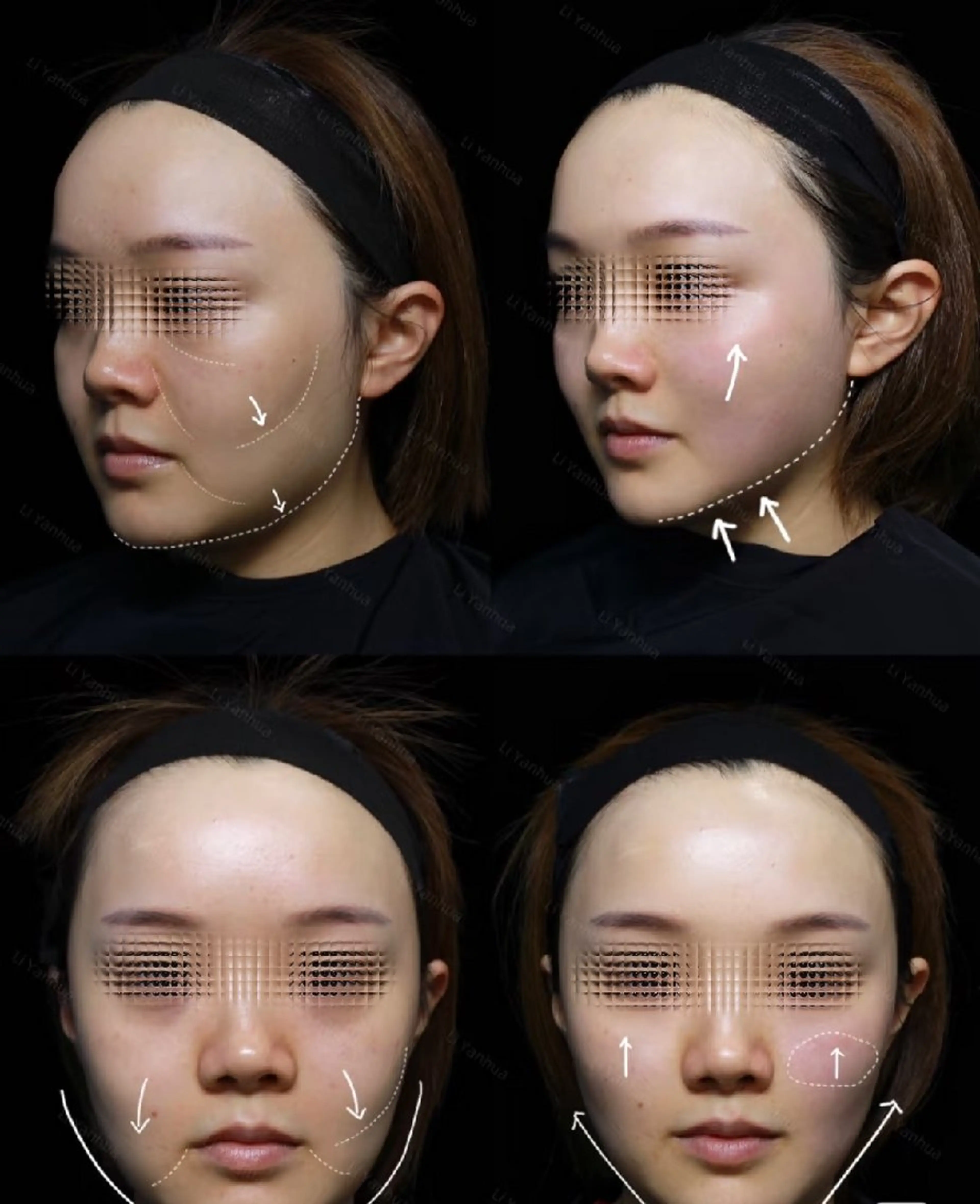 その他 aliaハイフ&水光ジェットサロン所属・aliaハーブ水光店 エステティシャン募集のエステ・リラクイメージ