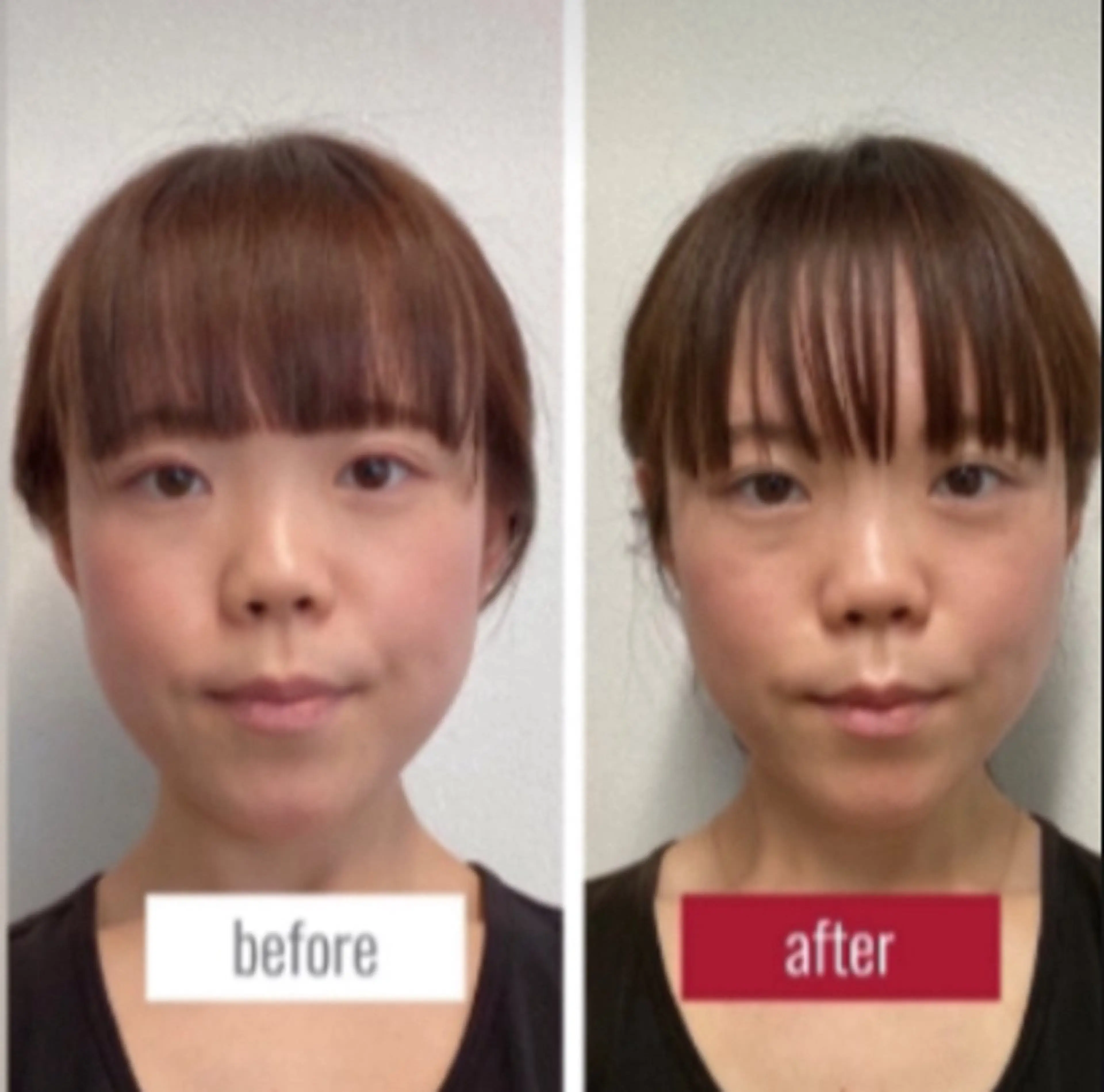 【京都人気No.1】小顔矯正+身体＋姿勢矯正フルセット90分【通常¥24,890】の写真