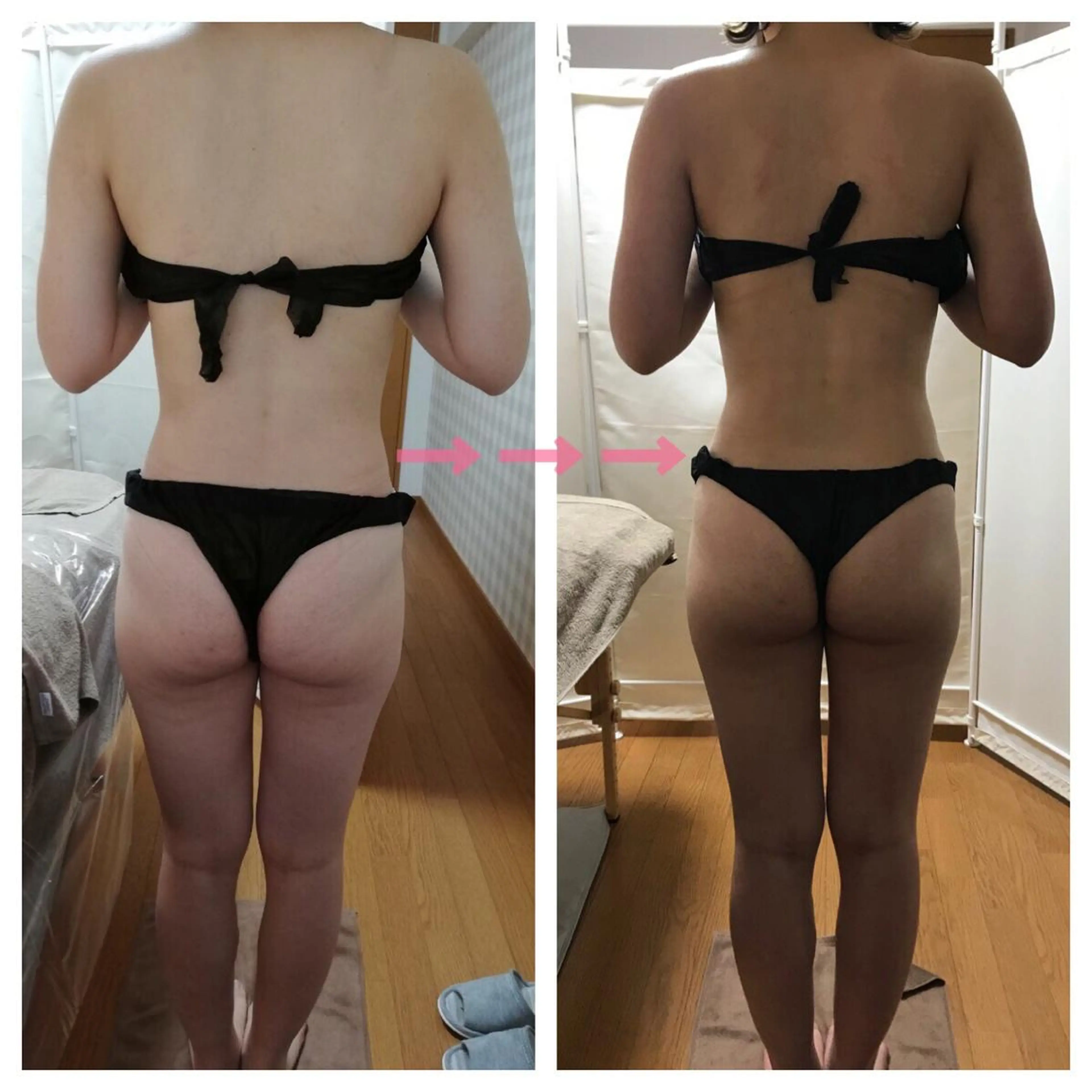 biloop所属・《痩身×疲労改善》 BILOOPのエステ・リラクイメージ