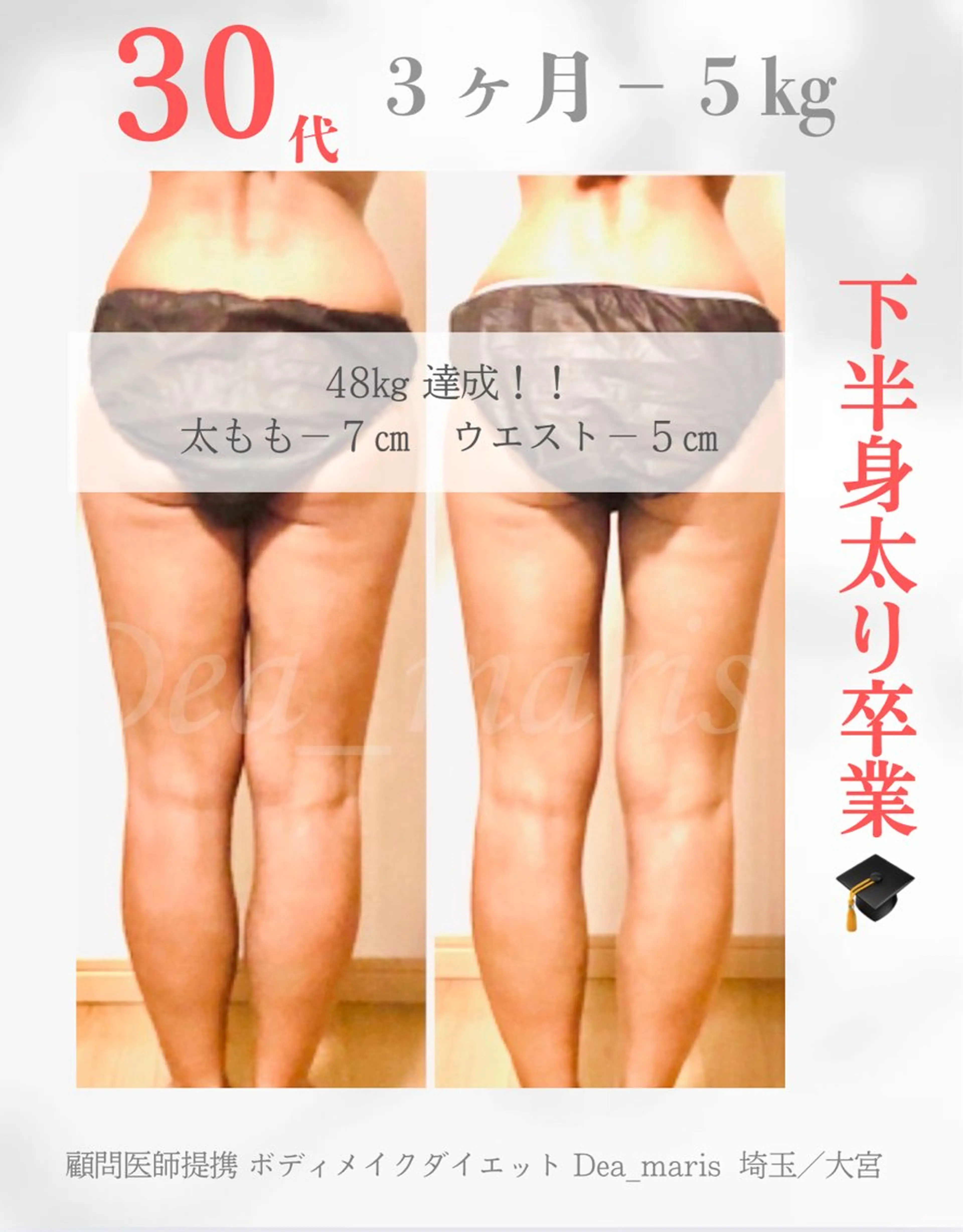 private salon  Dea_maris シュガーリング＆パーソナルボディケア所属・シミ改善・韓国肌管理 ボディメイク痩身のその他イメージ