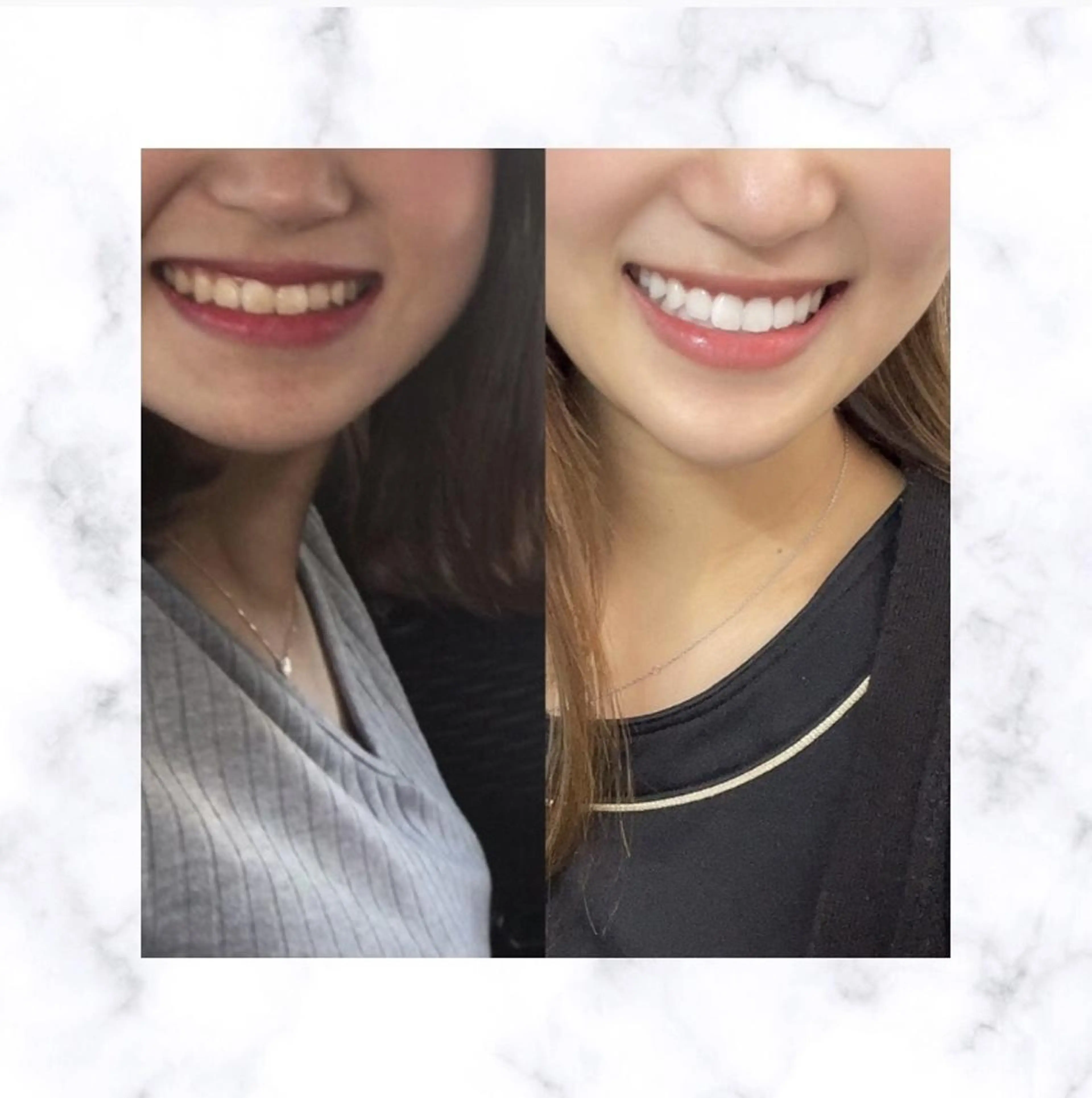 その他 ホワイトニング専門店 LCS 銀座店 峰岡のその他イメージ