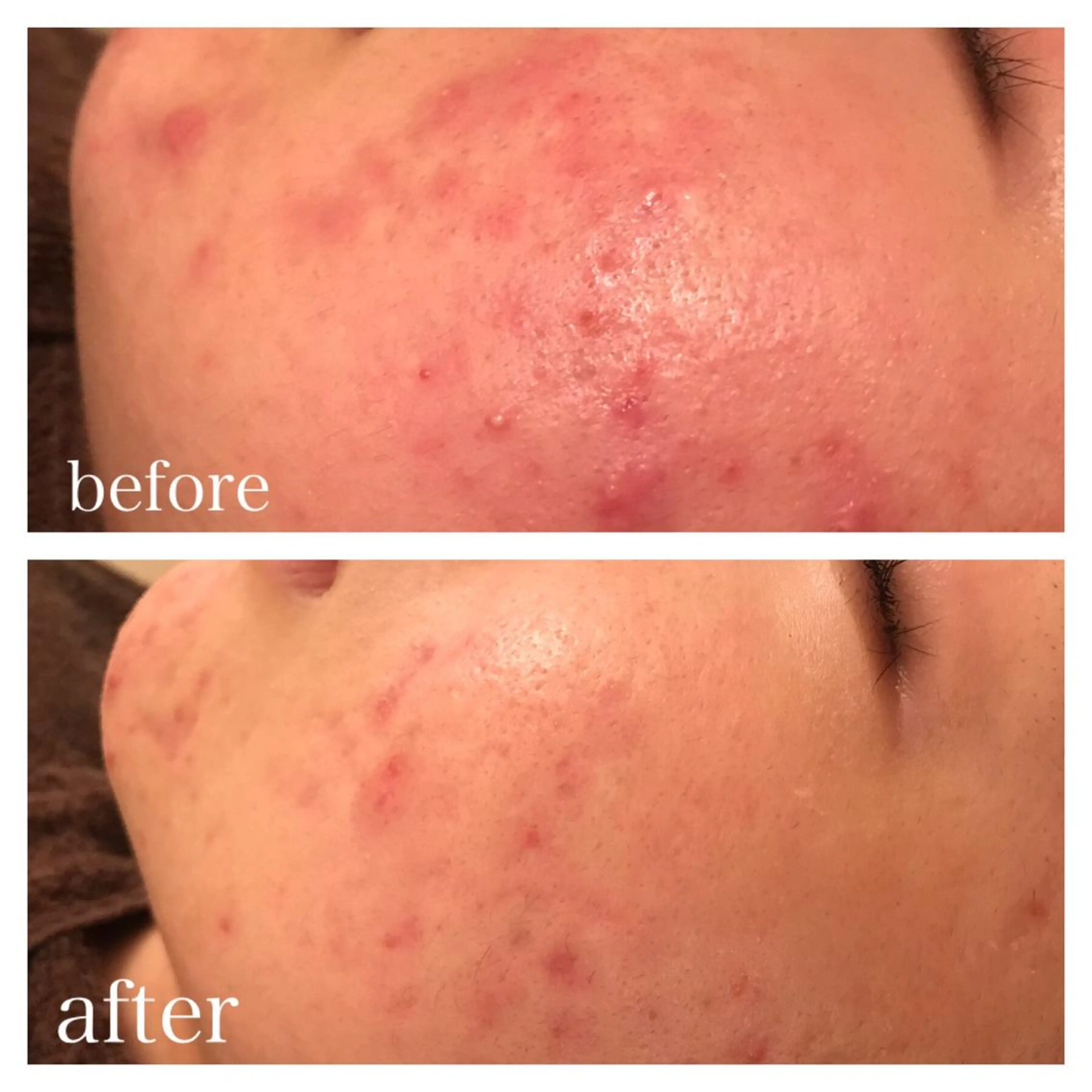 セミロング マツエク・マツパ エステ リラク ニキビ跡専門サロン Ａｉｎａのエステ・リラクイメージ