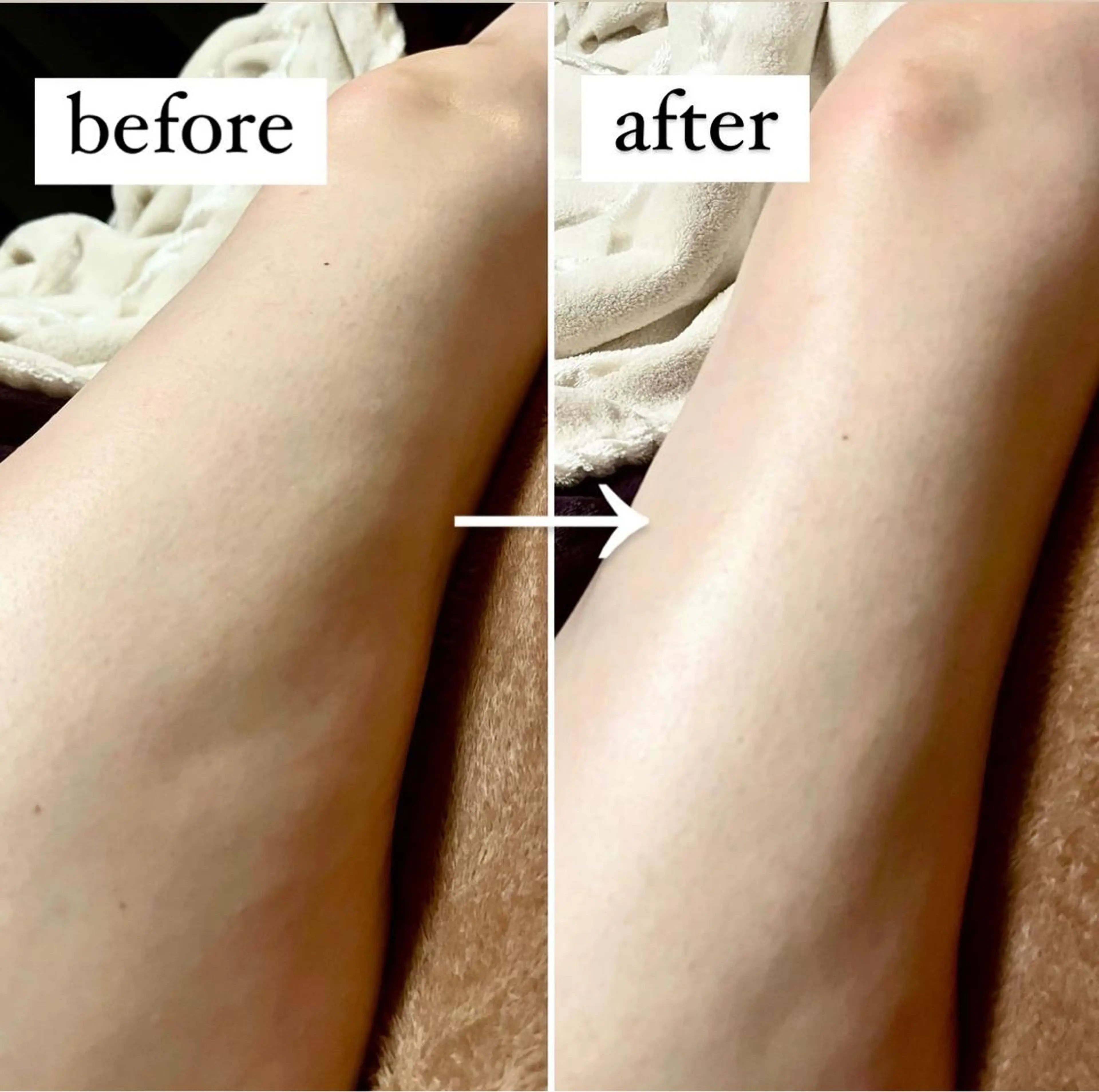 リラク アイカワールド所属・鈴木 愛加のエステ・リラクイメージ