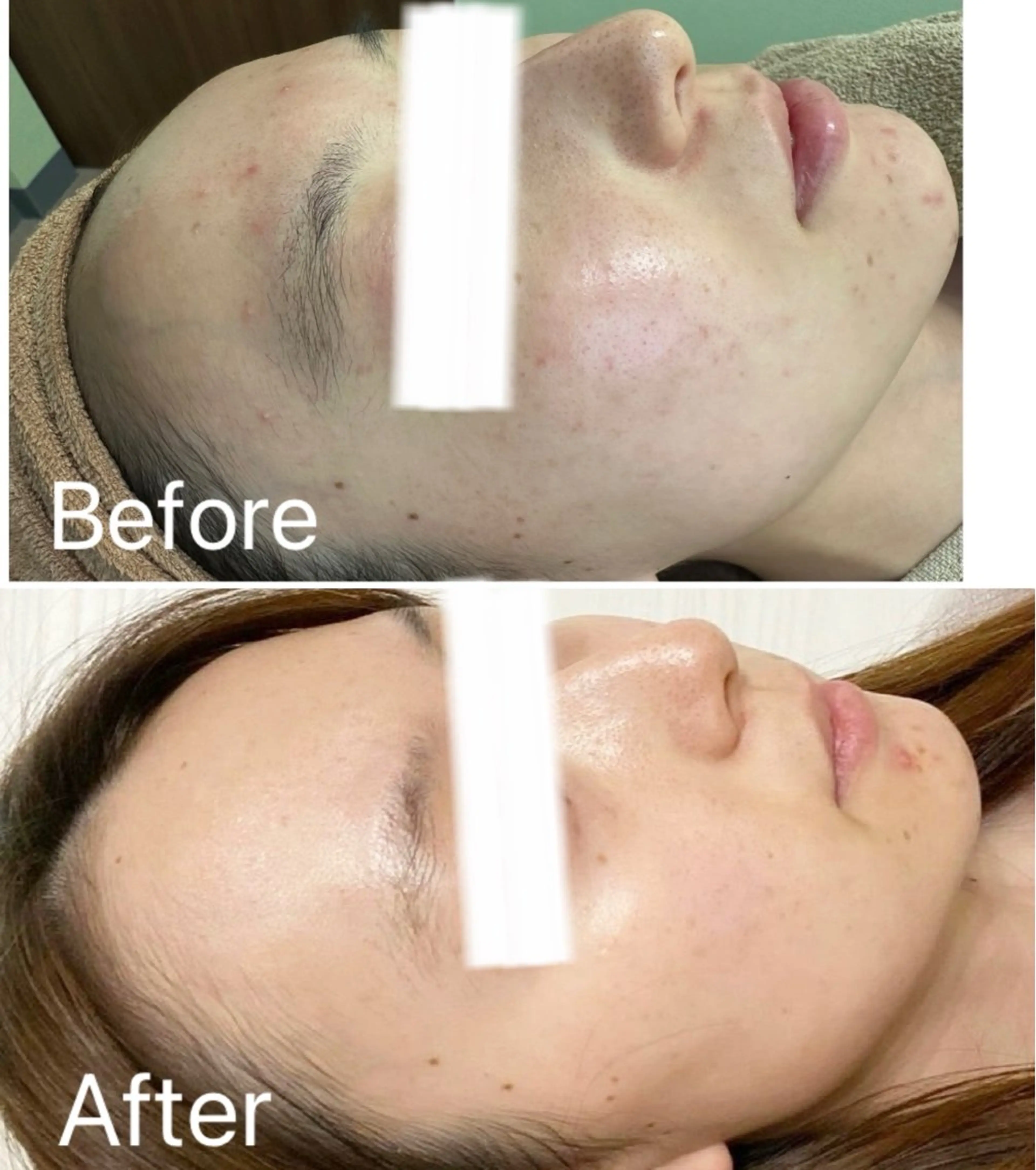 エステ 高崎トリニティ接骨院所属・舘野 はるかのエステ・リラクイメージ