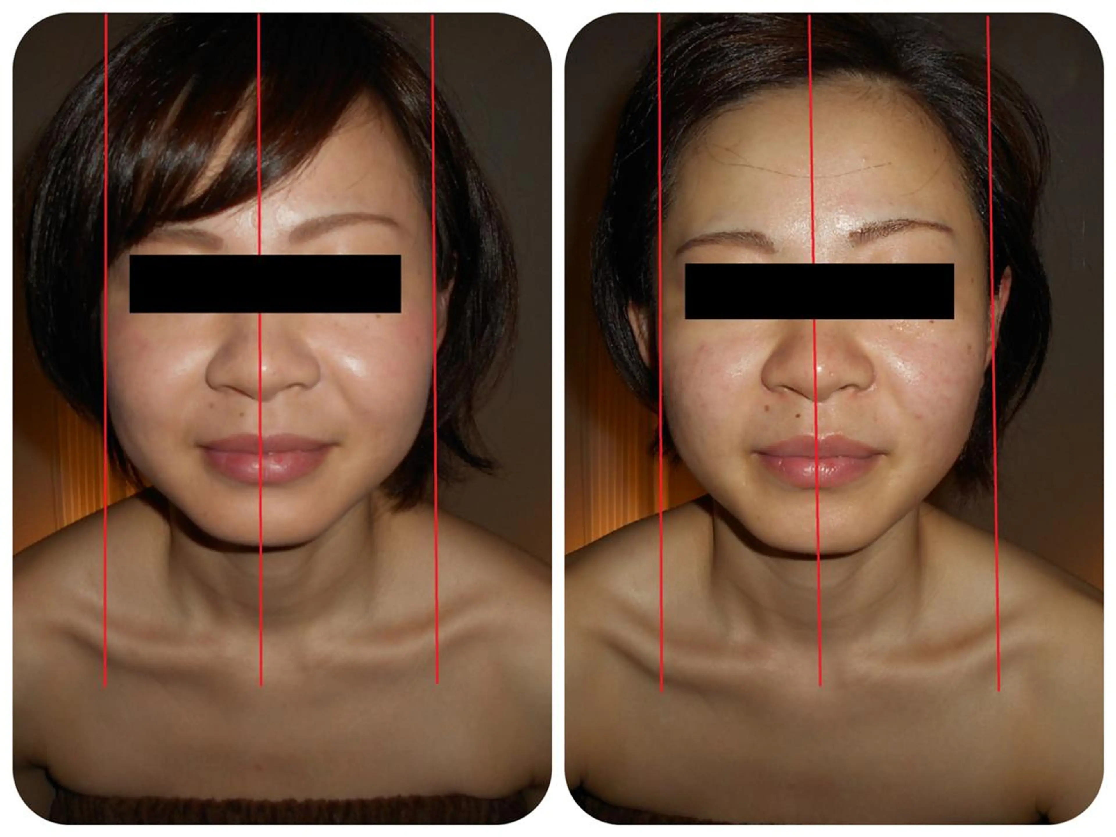 小顔専門店 グレイスボディ三郷店のエステ・リラクイメージ