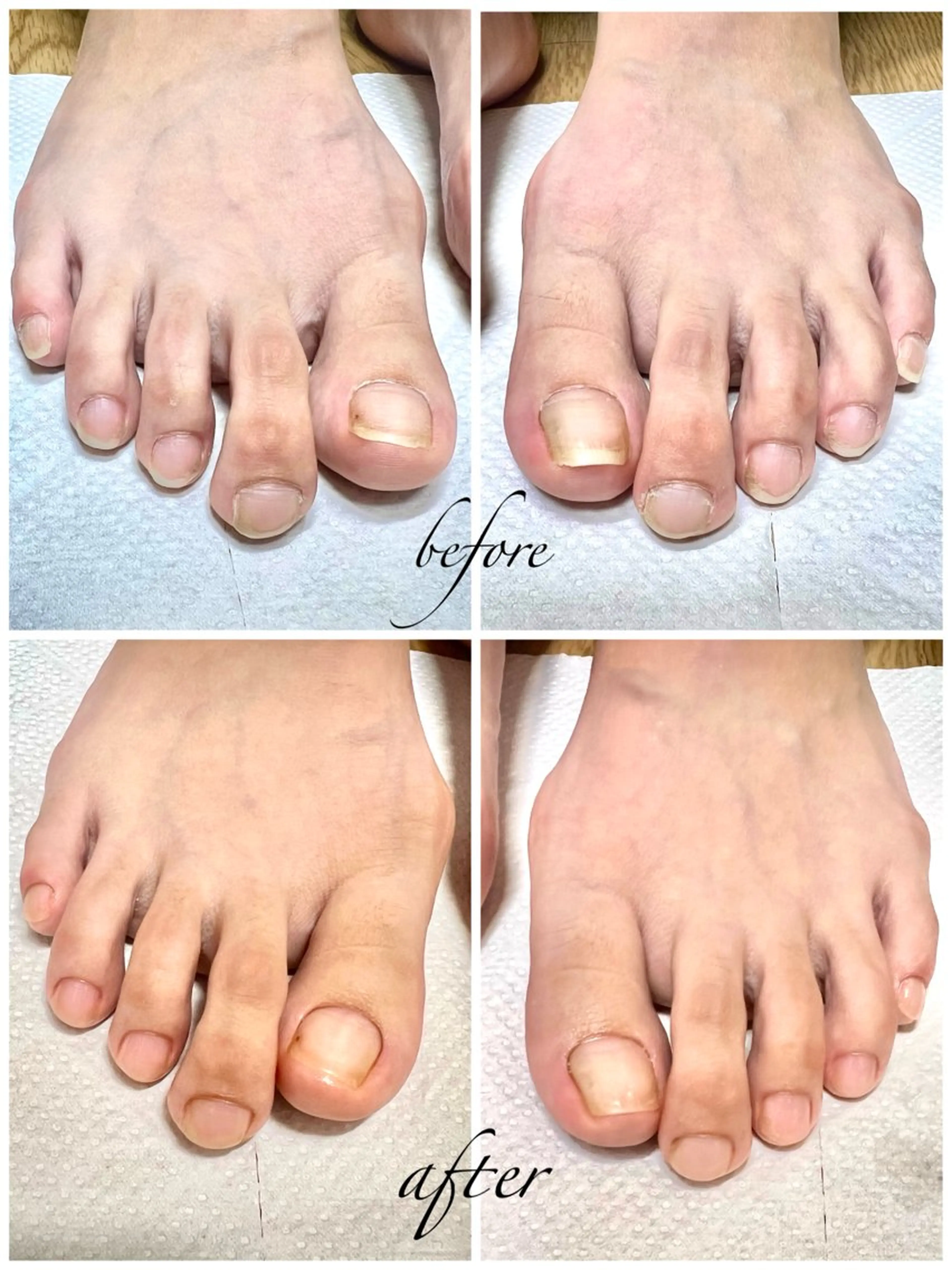 ネイル フットネイル Belulu所属・Belulu ベルルのネイルデザイン