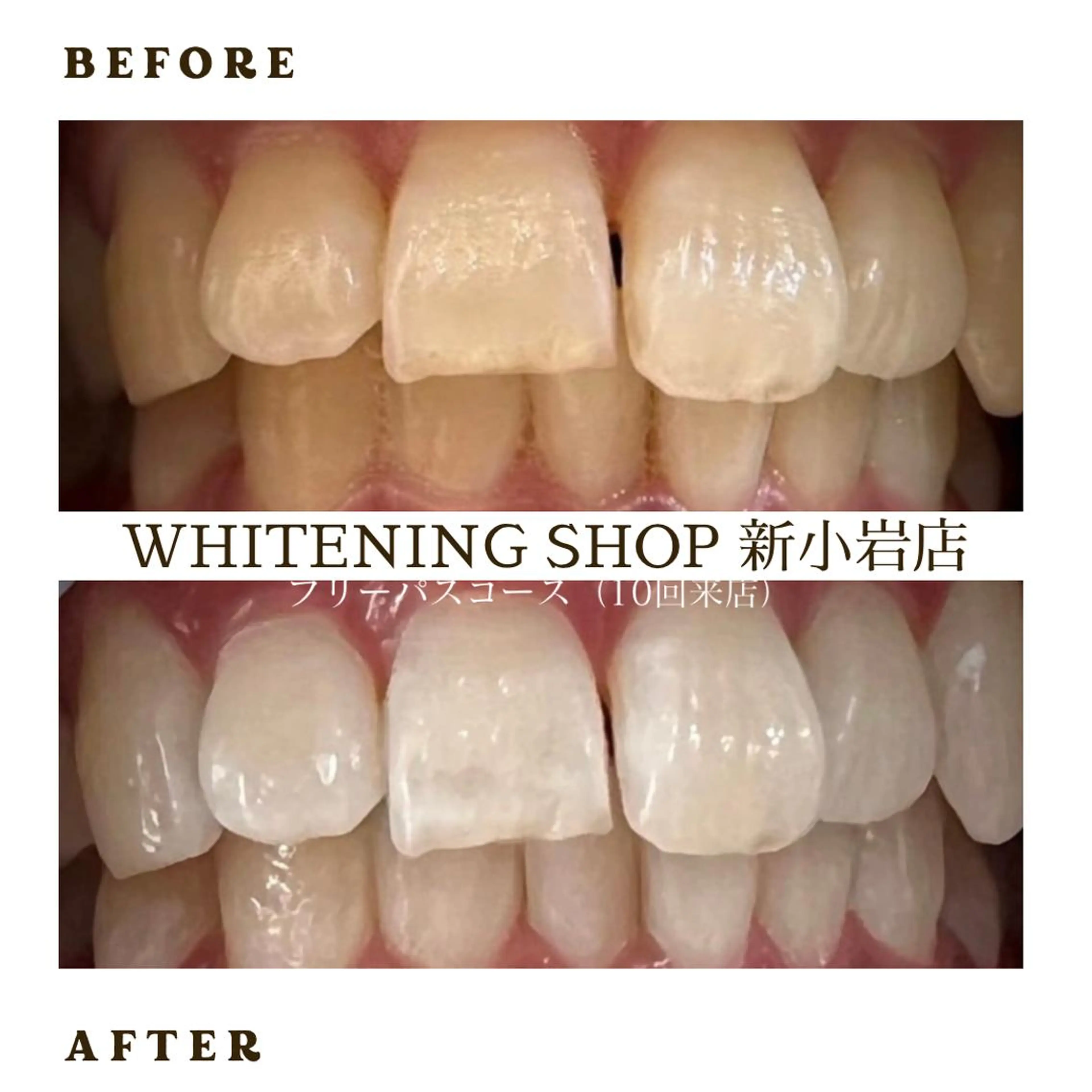 メンズ その他 ホワイトニング ショップ新小岩店のその他イメージ